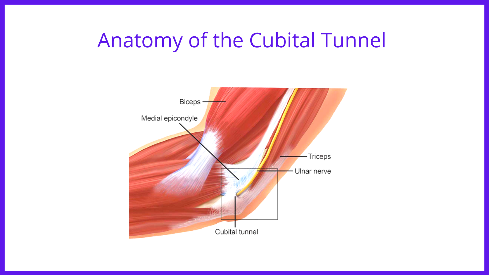 Anatomy of the Cubital Tunnel as the Ulnar Never enters and exits the elbow