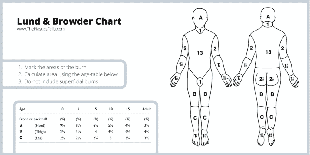 Lund and Browder Chart - Calculate Total Body Surface Area  Percentage (TBSA%) in Burns