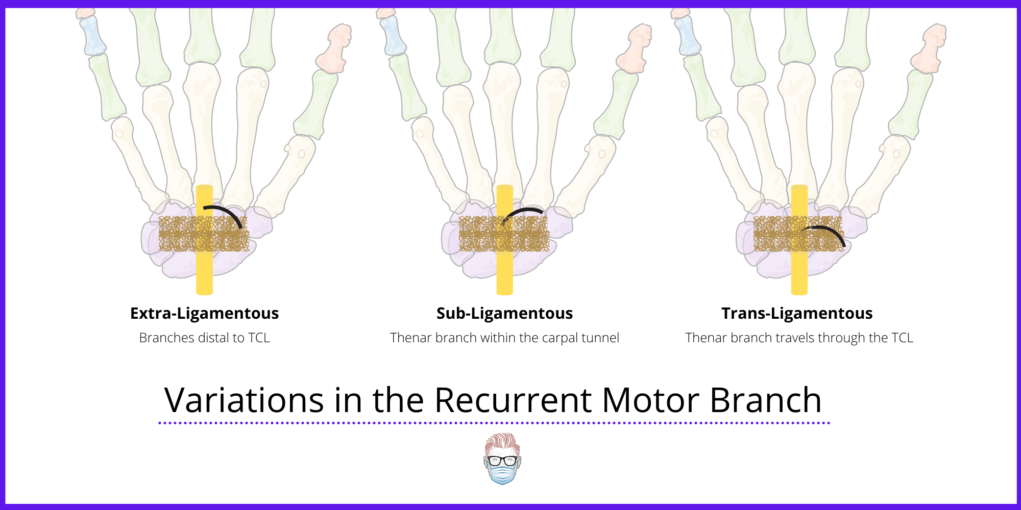 The Thenar Branch during carpal tunnel syndrome surgery