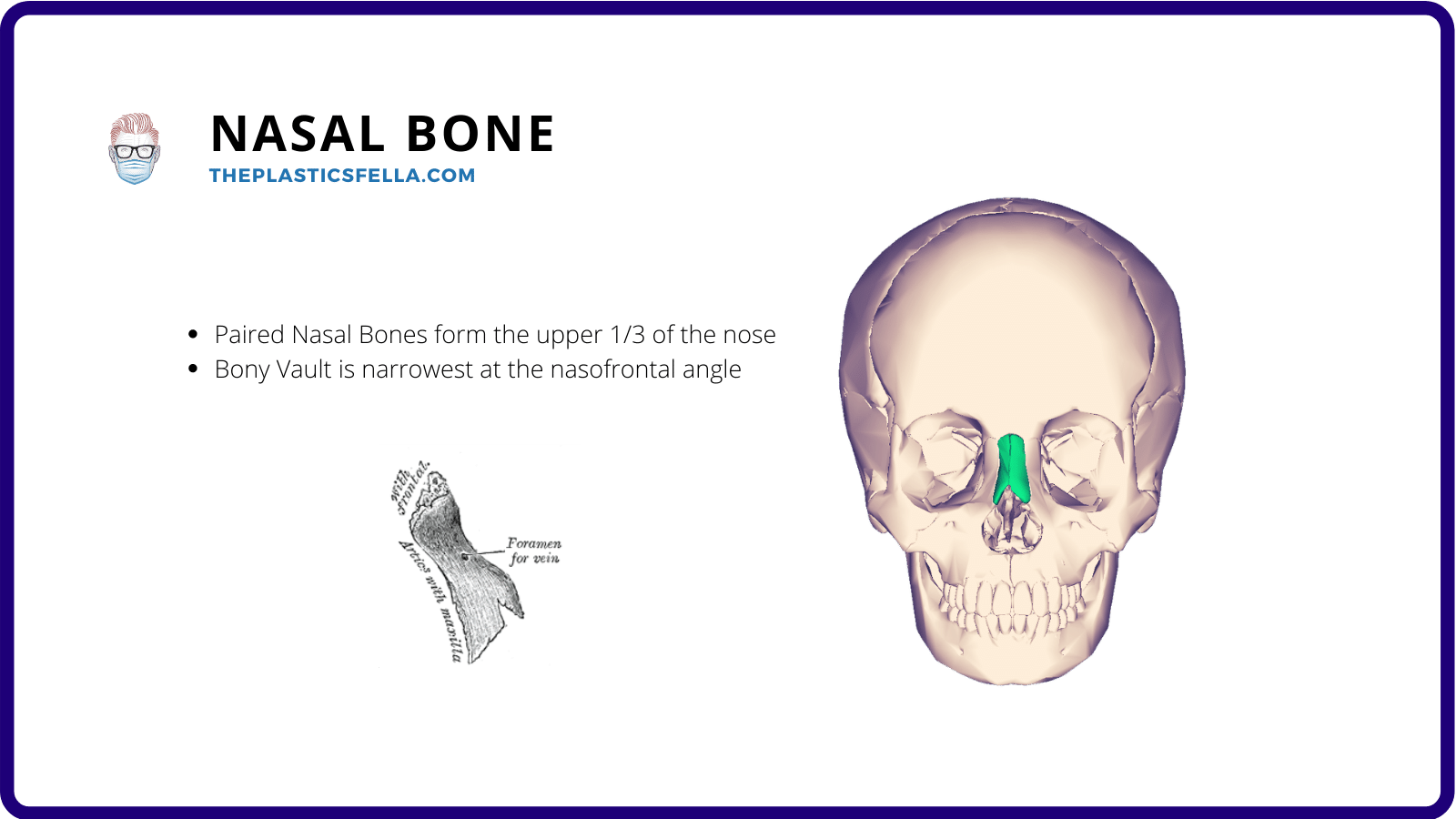 The location of the nasal bone in relation to other bones in the nose