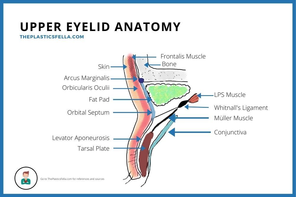 Upper Eyelid Anatomy Labelled Diagram with drawings of the anterior, posterior and middle lamella.