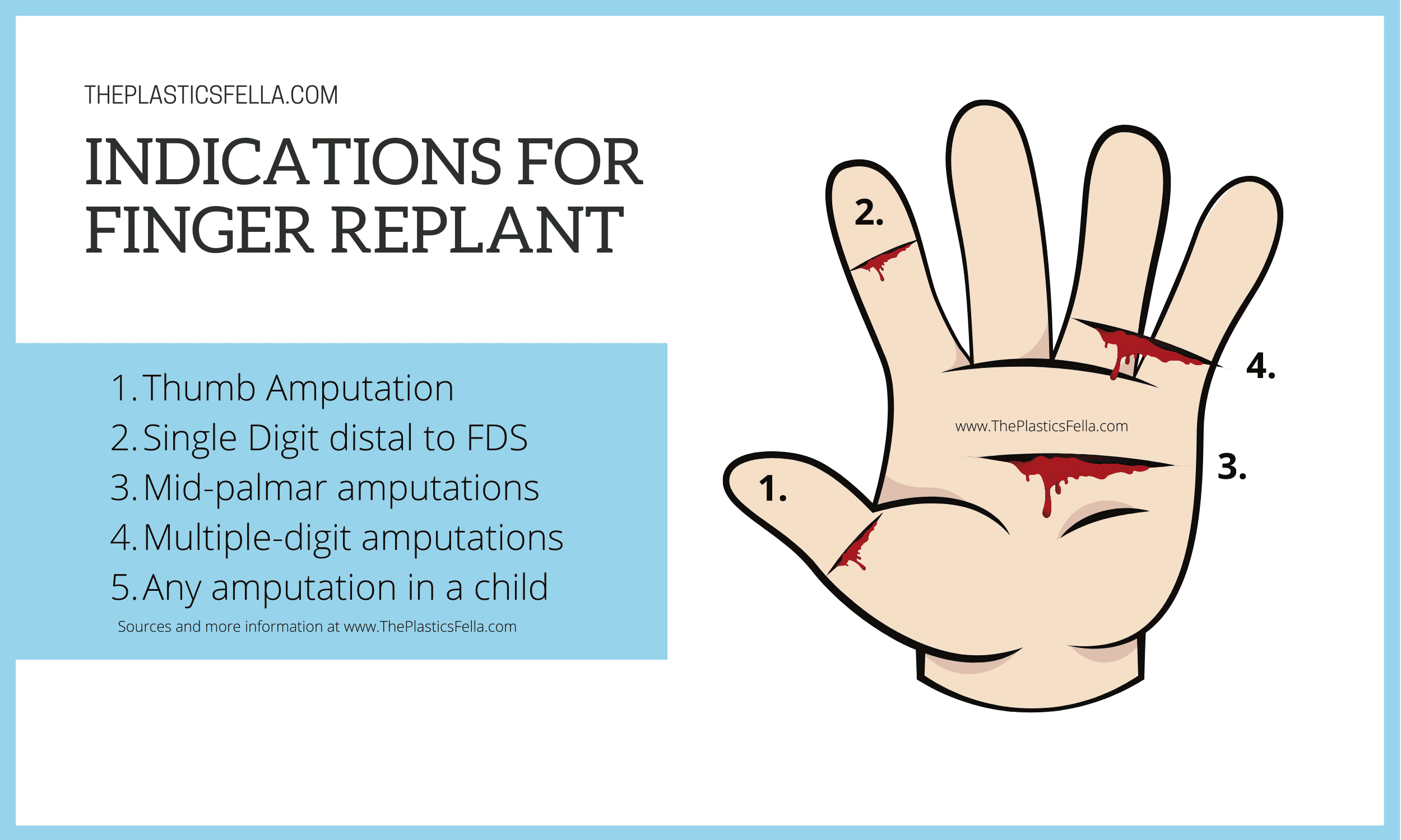 Indications for Finger Replant after amputation in adult and child or paediatric patient. Thumb, fingers and palms