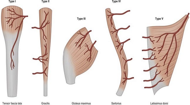 Visual illustration of the Mathes and Nahai Classification for muscle flaps