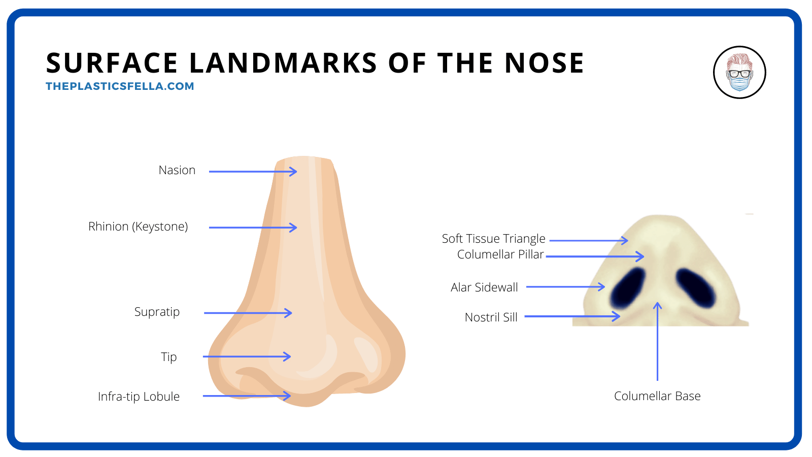 Clinical Anatomy of the External Nose and Surface Landmarks for Plastic Surgeons and Rhinoplasty