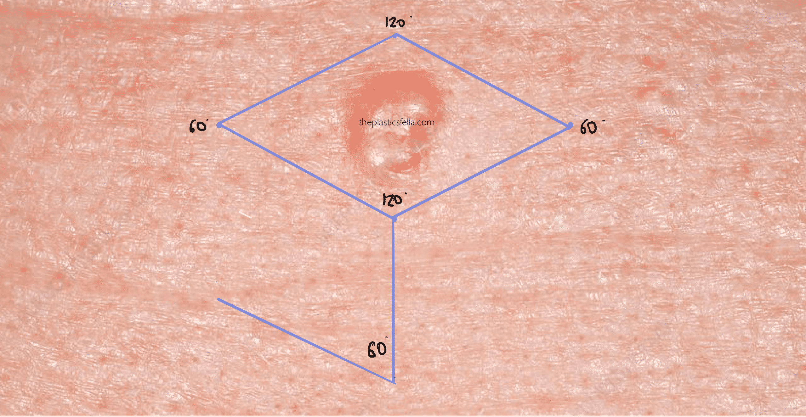 Drawing a rhomboid flap