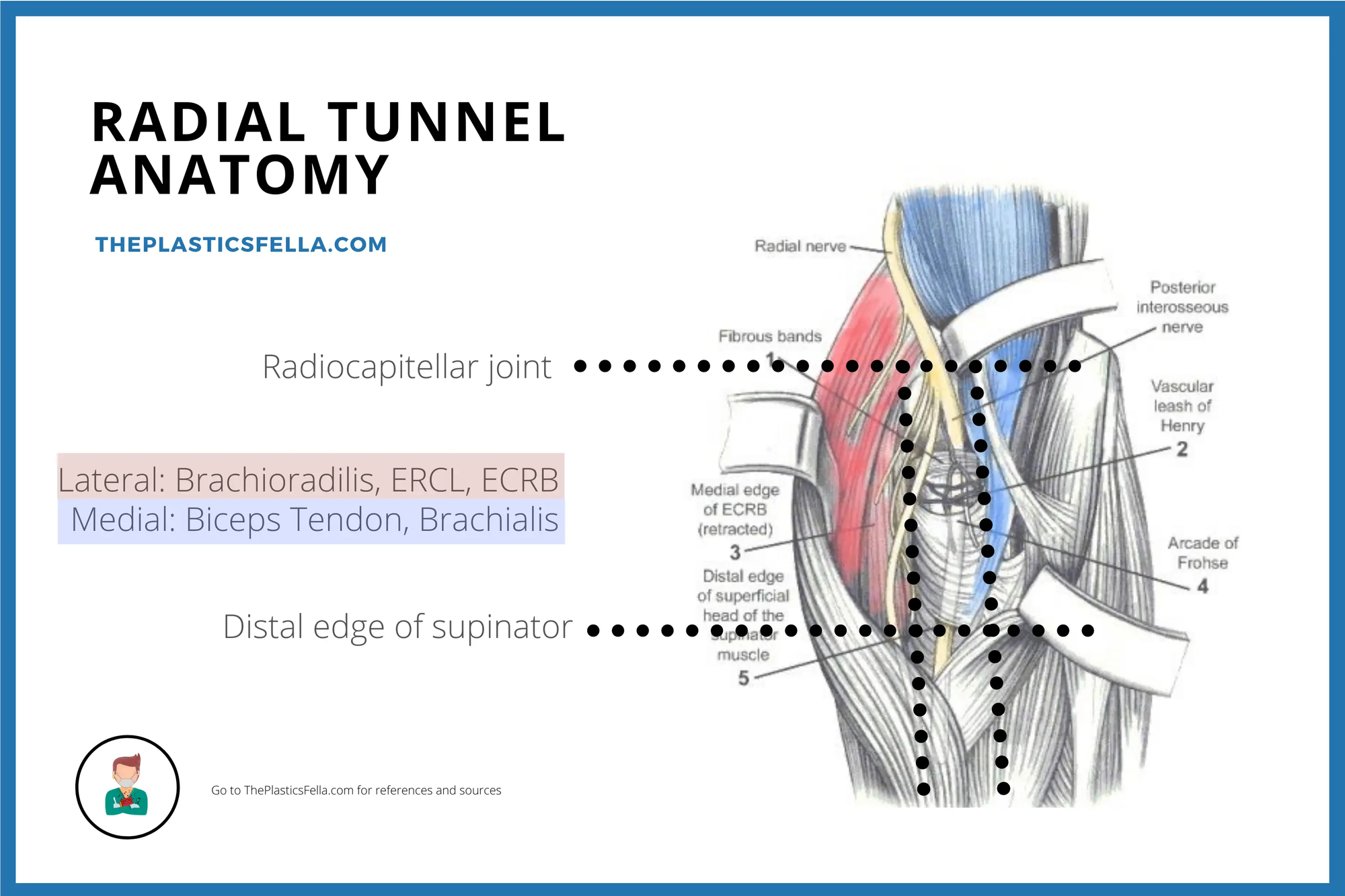 Radial Tunnel, Anatomy, PIN Nerve, PIN Palsy, PIN Syndrome