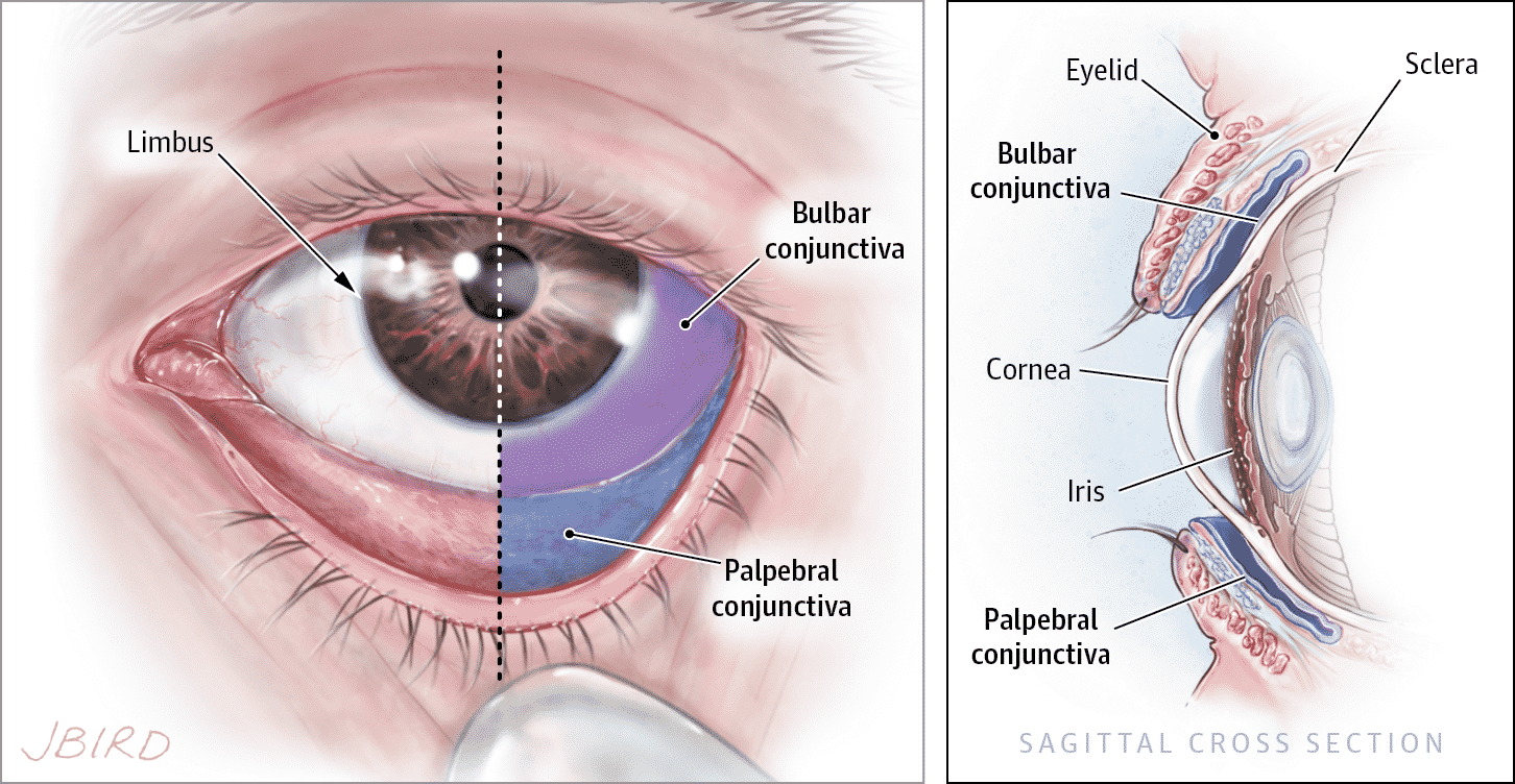 Конъюнктива где. Конъюнктива склеры строение. Конъюнктивит мешок конъюнктивальный. Строение глаза анатомия конъюнктива. Оболочки глаза конъюнктива.