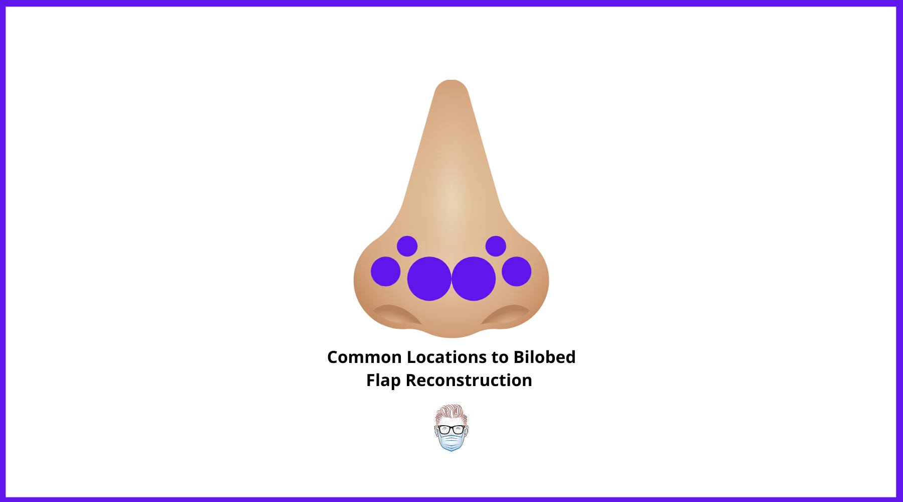 Indications for Bilobed Flap Reconstruction on the Nasal Tip and Nasal Defect Size, medial canthus