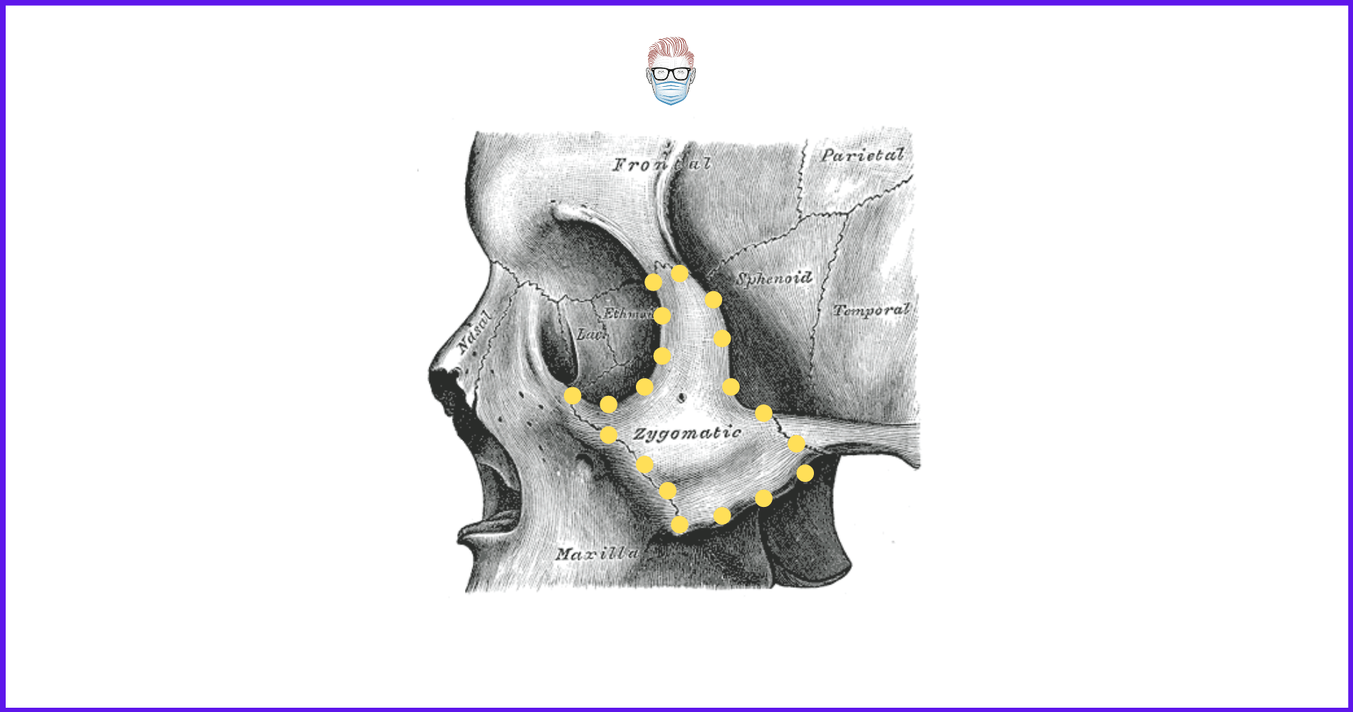 Anatomy of the Zygomaticomaxillary complex, fractures, zygoma, maxilla, facial fractures