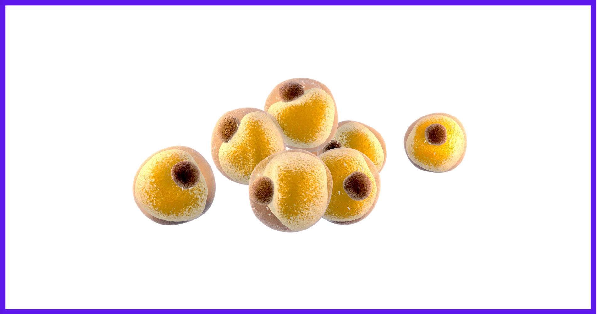Liposuction Anatomy of Fat Cells and Adipocytes in Fat Lobules