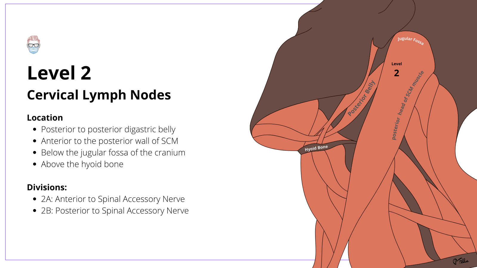 Level 2 Cervical Lymph Nodes, Level 2A, Level 2B, spinal accessory nerve, upper jugular, cervical nodes