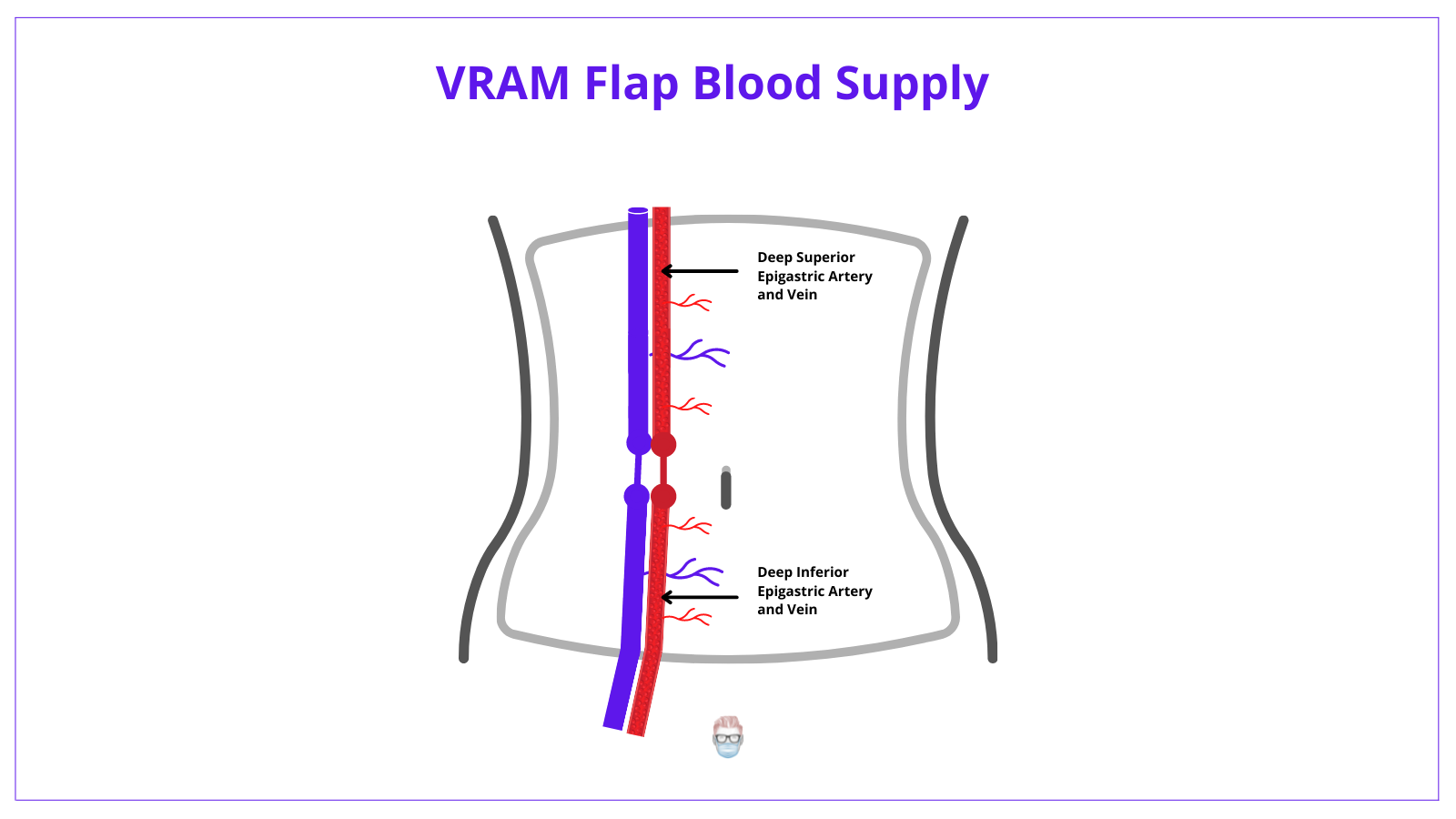 VRAM Flap, VRAM anatomy, RAM Flap, vertical rectus abdominis muscle flap, rectus abdominis muscle, anatomy