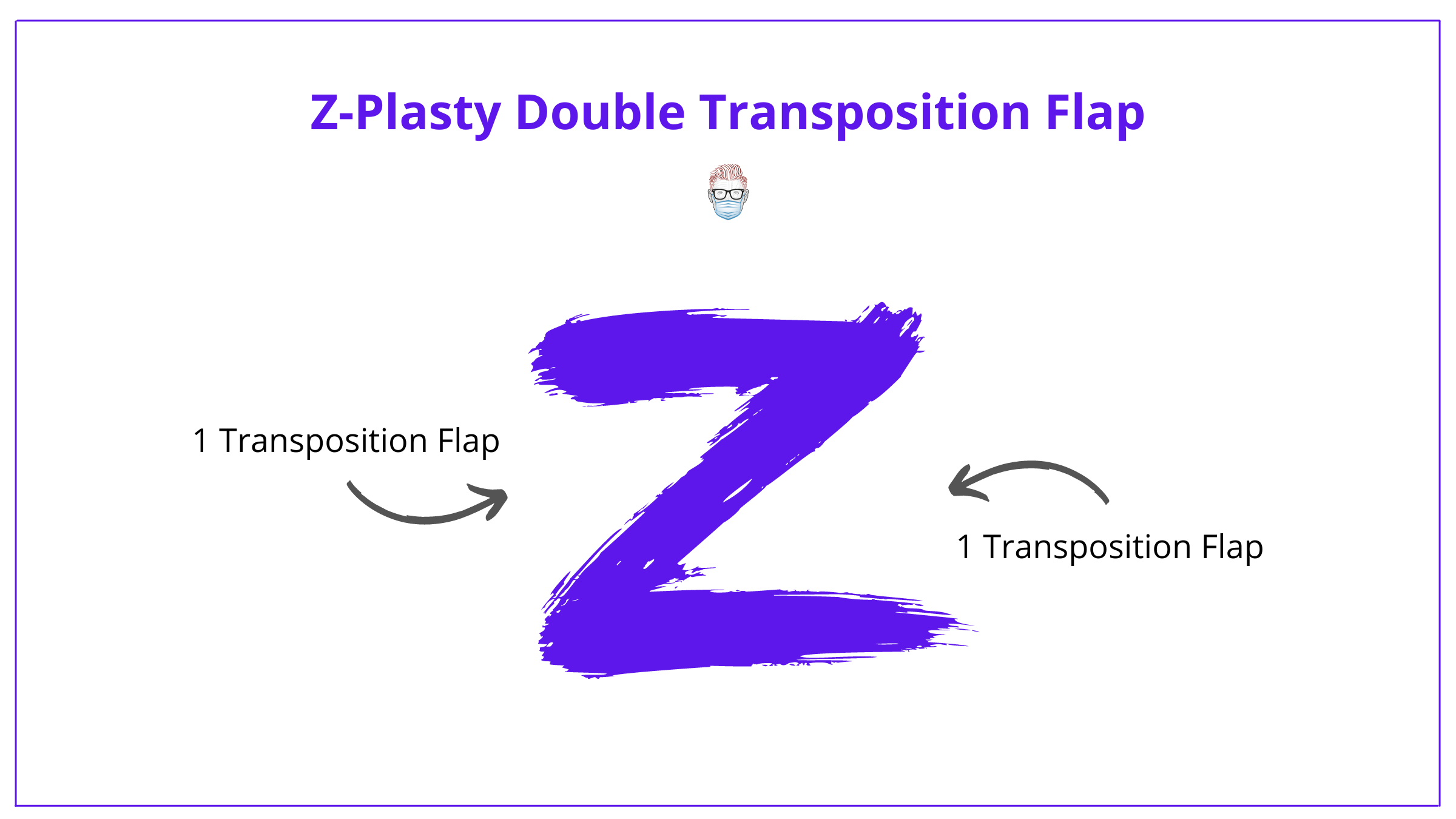 Z-plasty, Z-plasty flap, z-plasty design, z-plasty technique, z-plasty complications