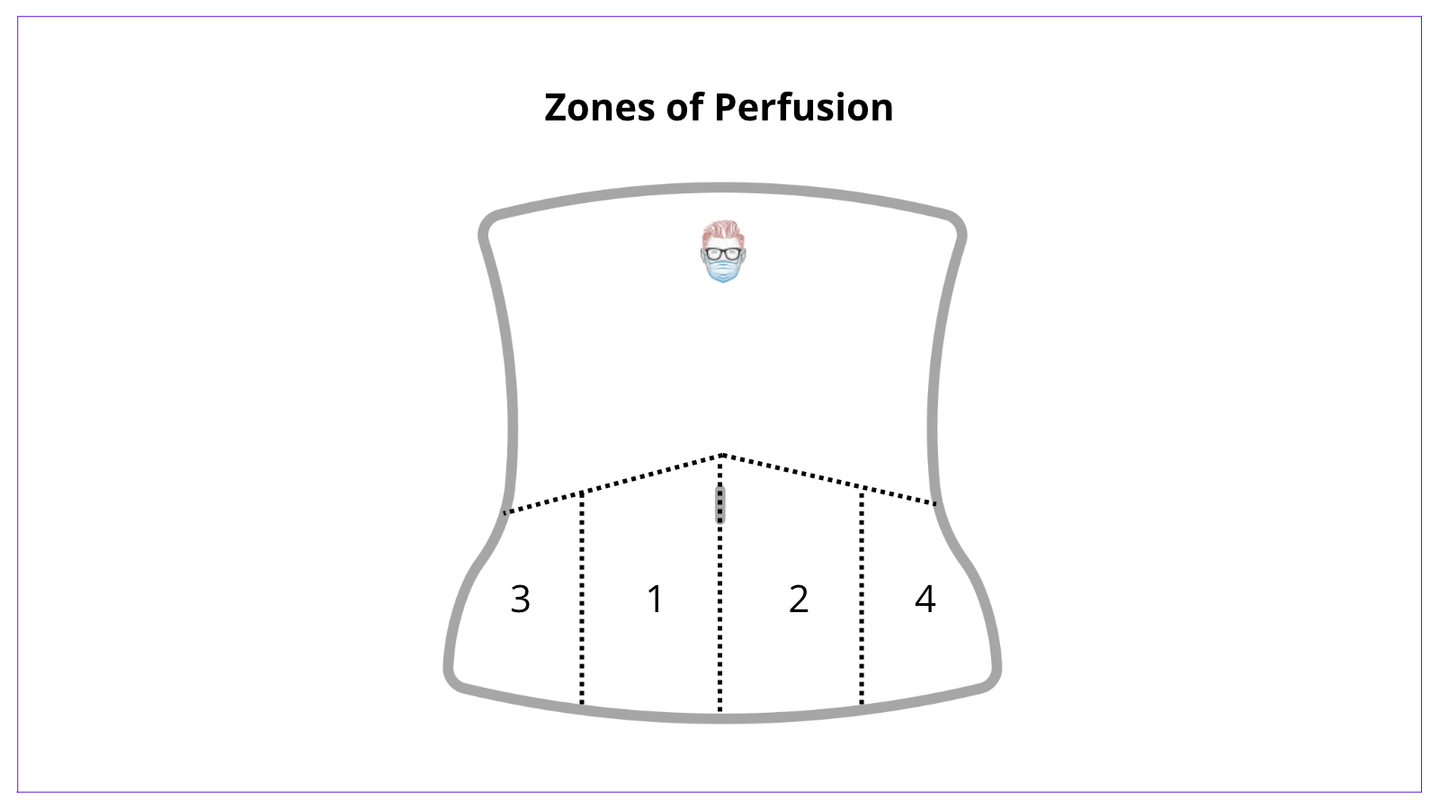 The angiosome principle allows the abdomen to be divided into 4 zones of perfusion