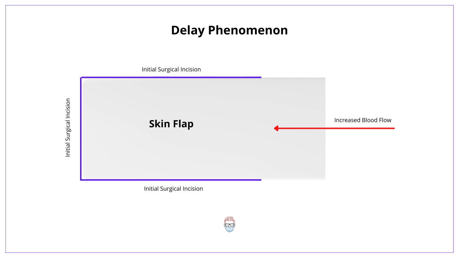 The delay phenomenon in flap surgery increases the blood flow by isolating the skin flap on it's planned blood supply.