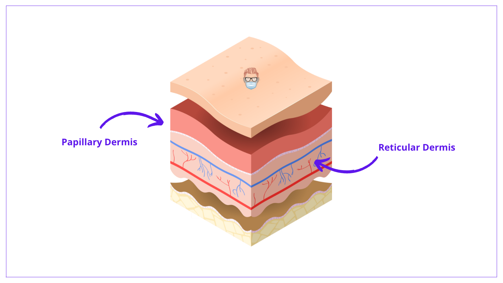 Layers of the dermis skin is described as papillary dermis and reticular dermis