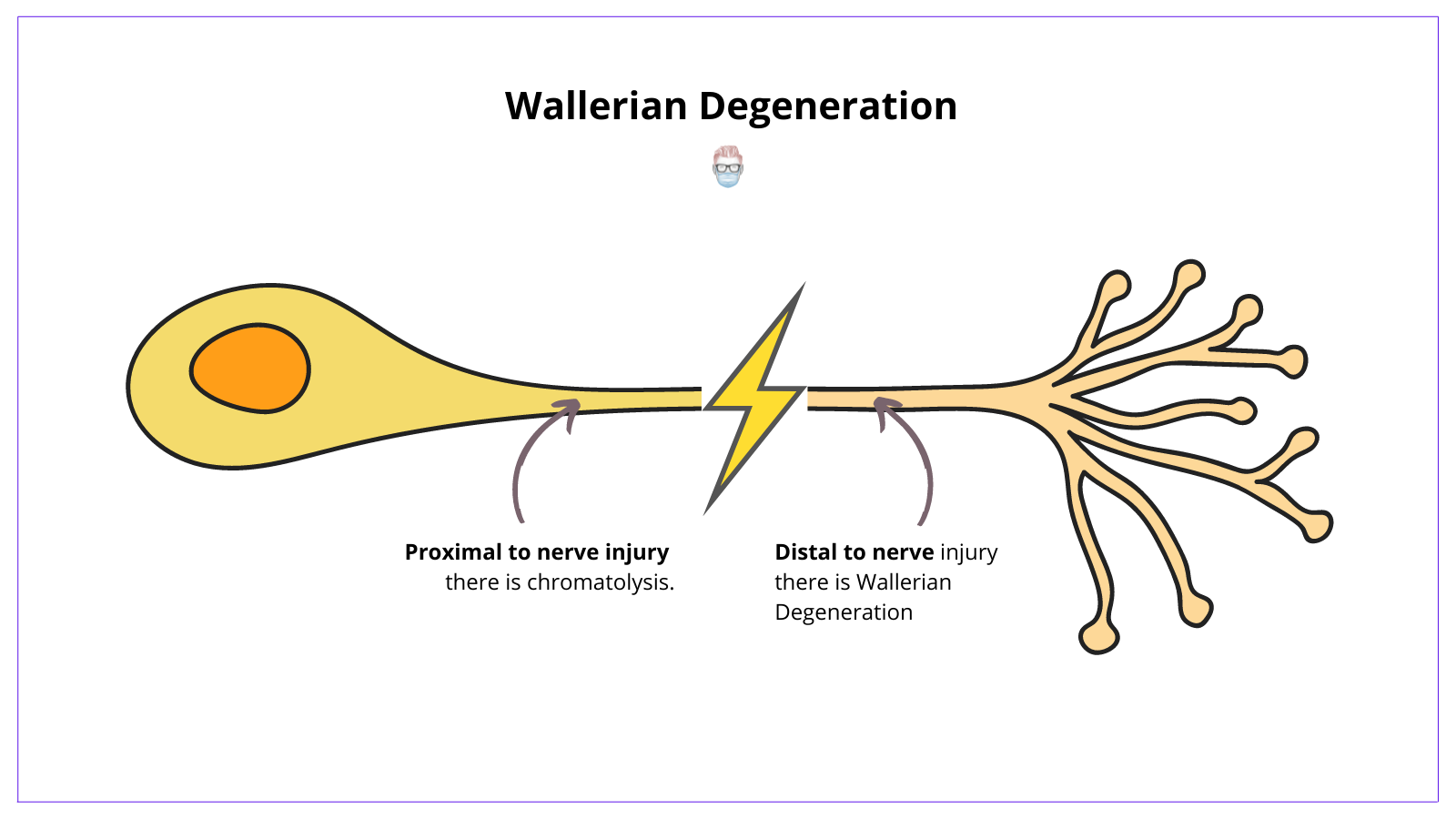 Wallerian degeneration occurs distal to the site of nerve injury