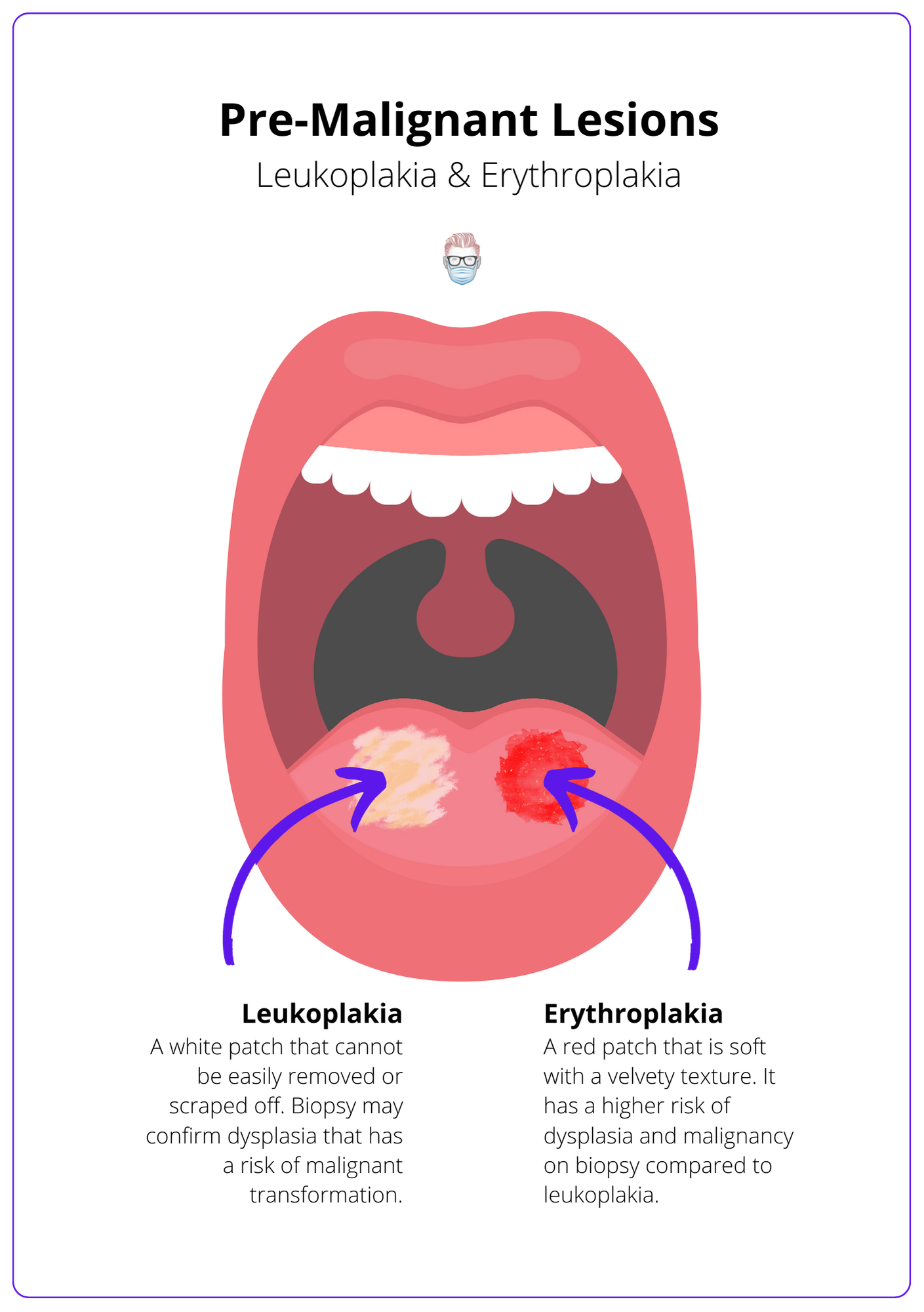 Leukoplakia and Erythroplakia are premalignant lesions for oral cavity tumours, SCCs and squamous cell cancers