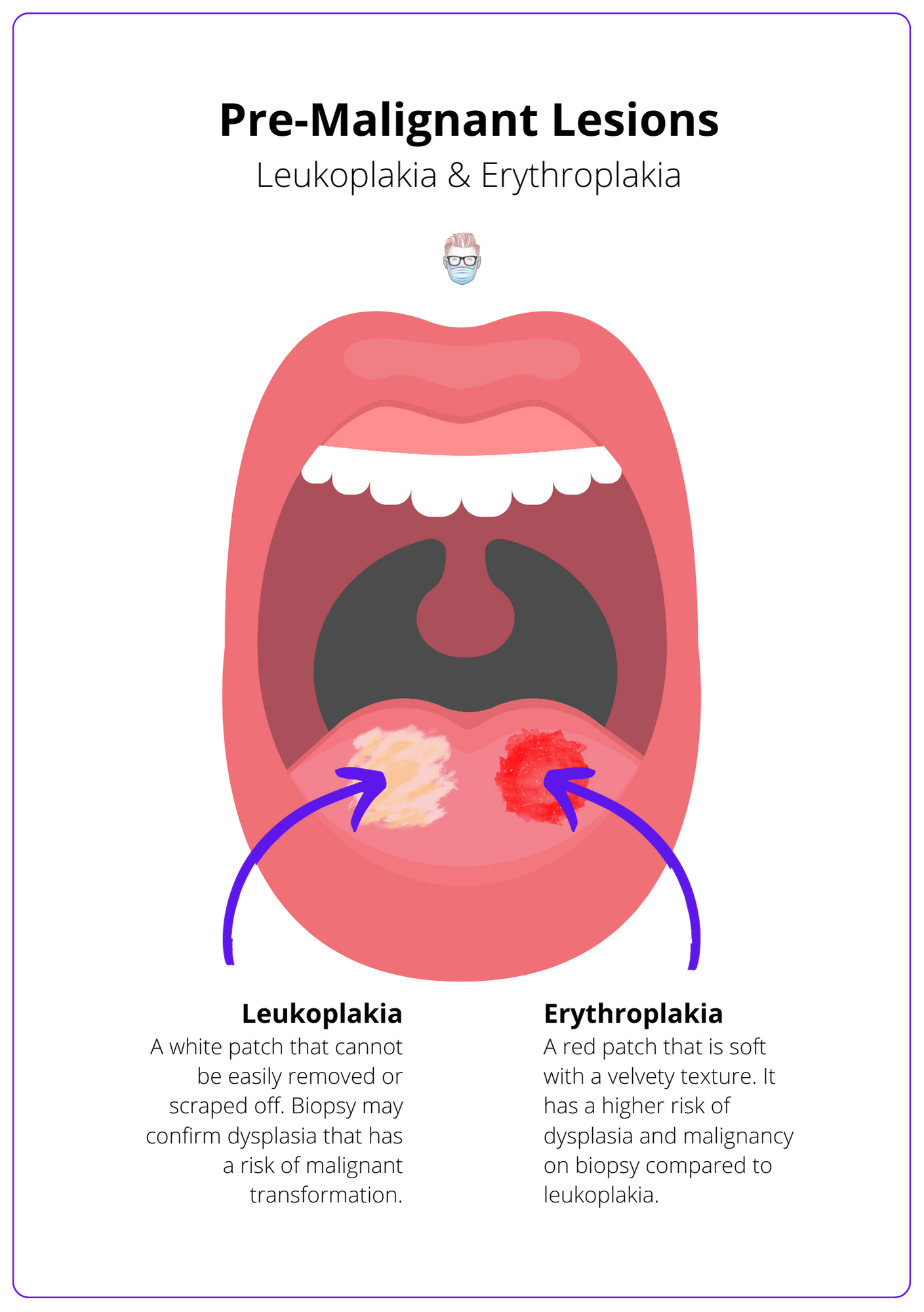 Erythroplakia Floor Of Mouth