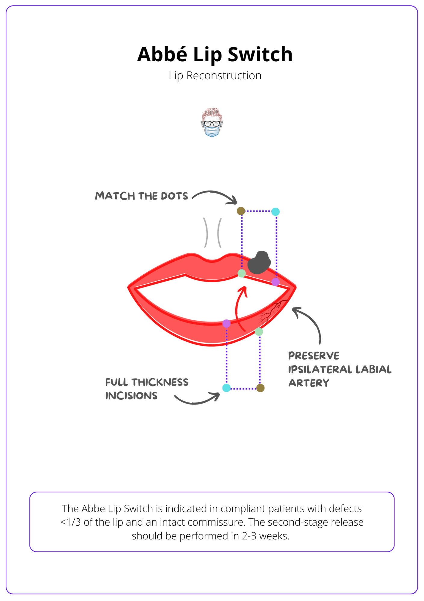 A labelled drawing of a red lip with a cancer. The lip is reconstruced with a blue dotted line to show a lip switch. Arrows show the arteries and incisions