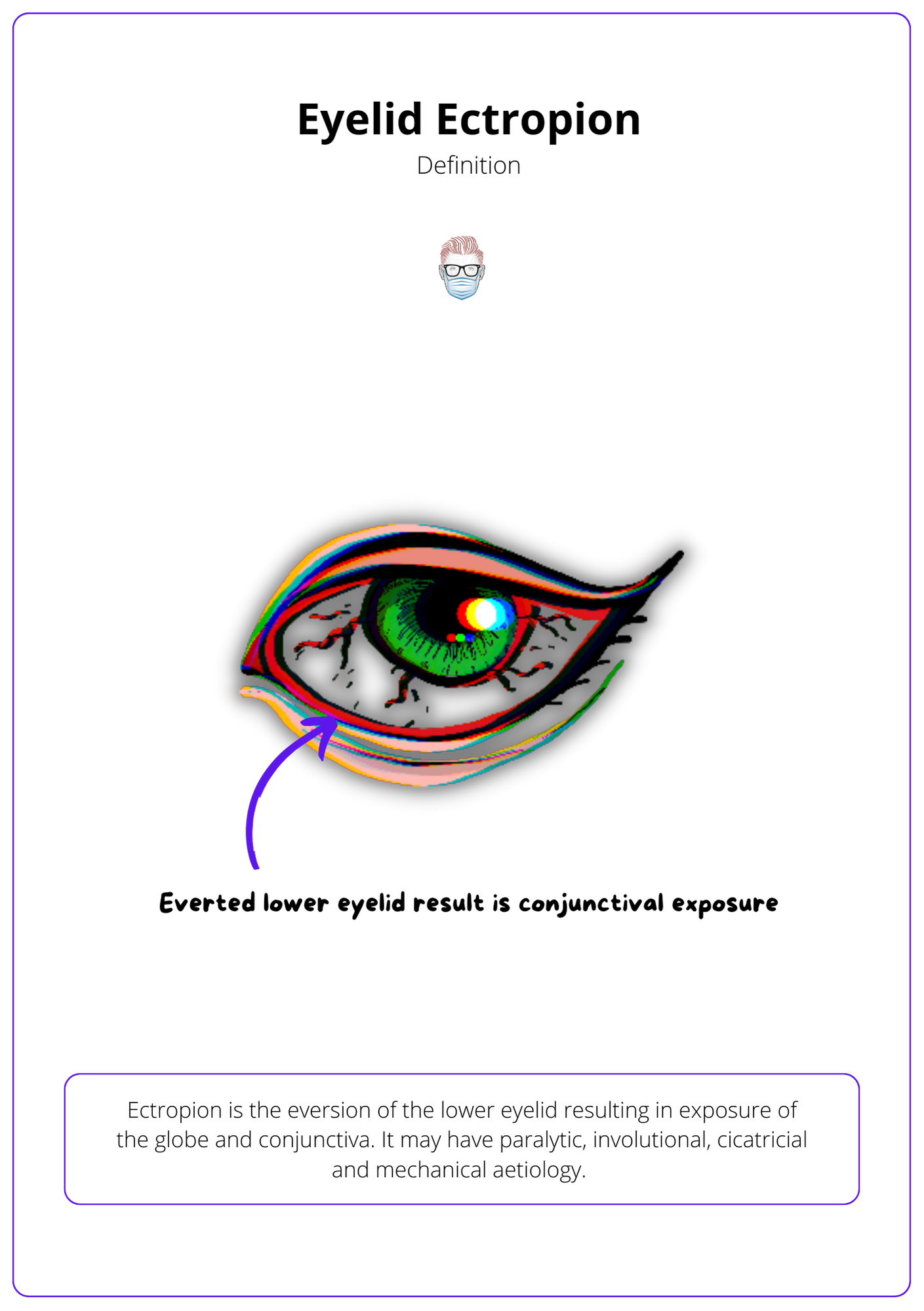 A labelled drawing of an eye with a blue arrow pointing to the ectropion of the lower eyelid. The box at the bottom of the image has the definition of an ectropion