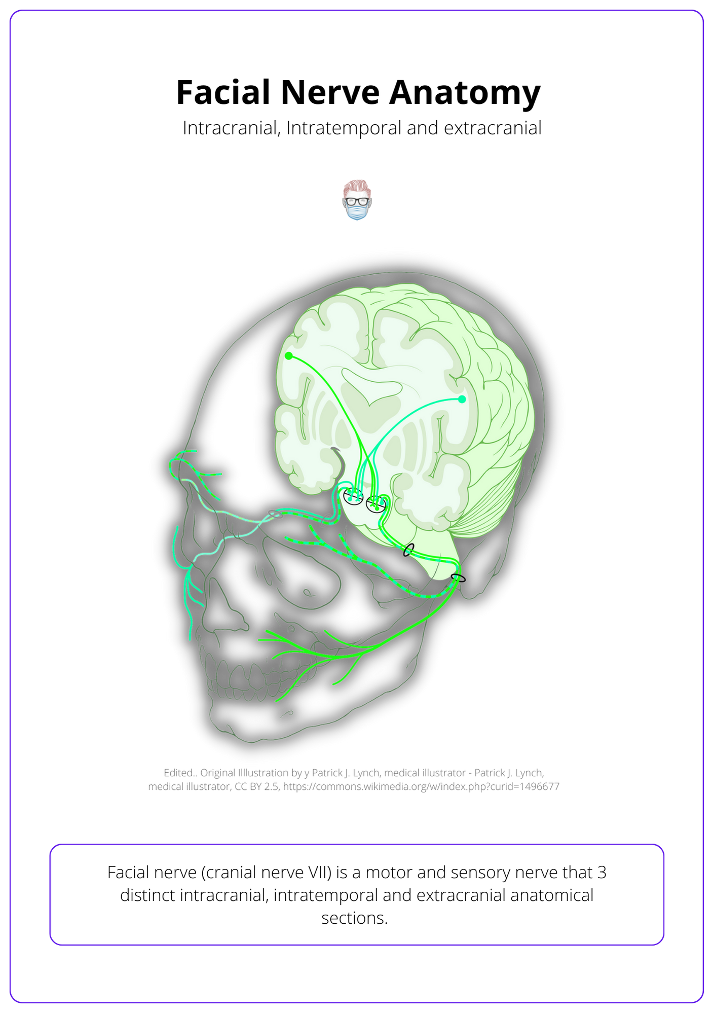 An illustrated diagram showing the facial nerve in yellow travel through its intracranial, extracranial and intratemporal anatomical sections