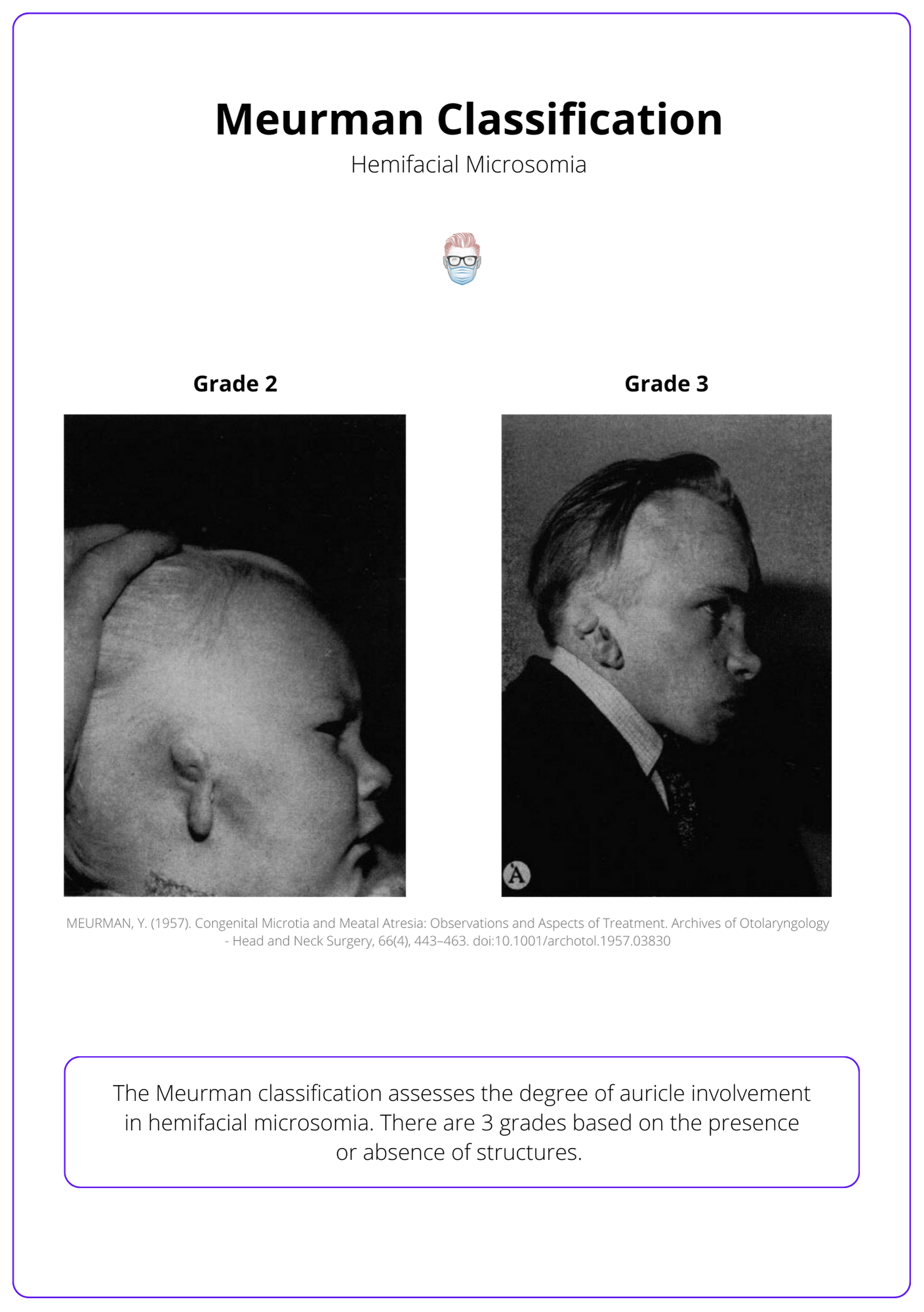 Meurman Classification of the Ear, Classification of Hemifacial Microsomia