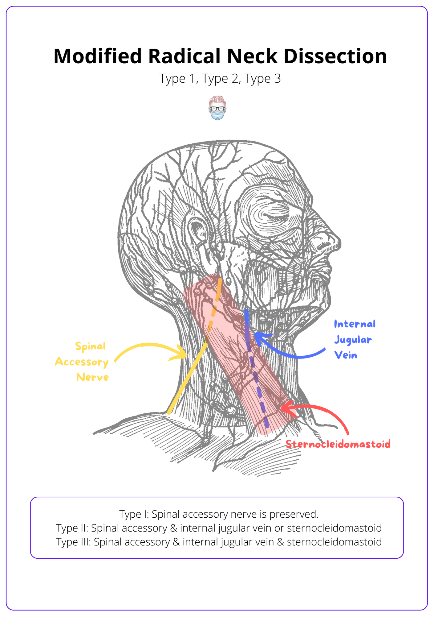 Neck Dissection · Types Anatomy Indications Complications