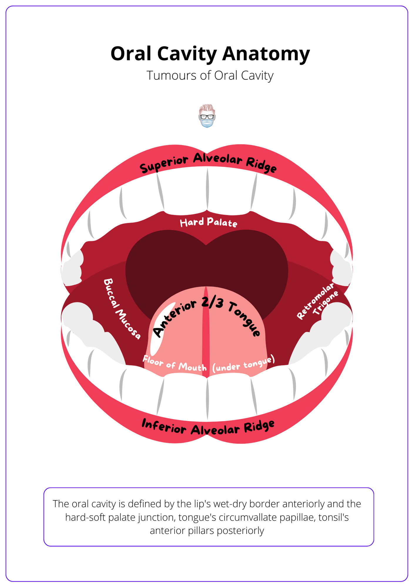 A labelled diagram of the oral cavity anatomy which contains the hard palate, buccal mucosa, retromolar trigone, floor of mouth, anterior 2/3 of tongue and inferior alveolar ridge.
