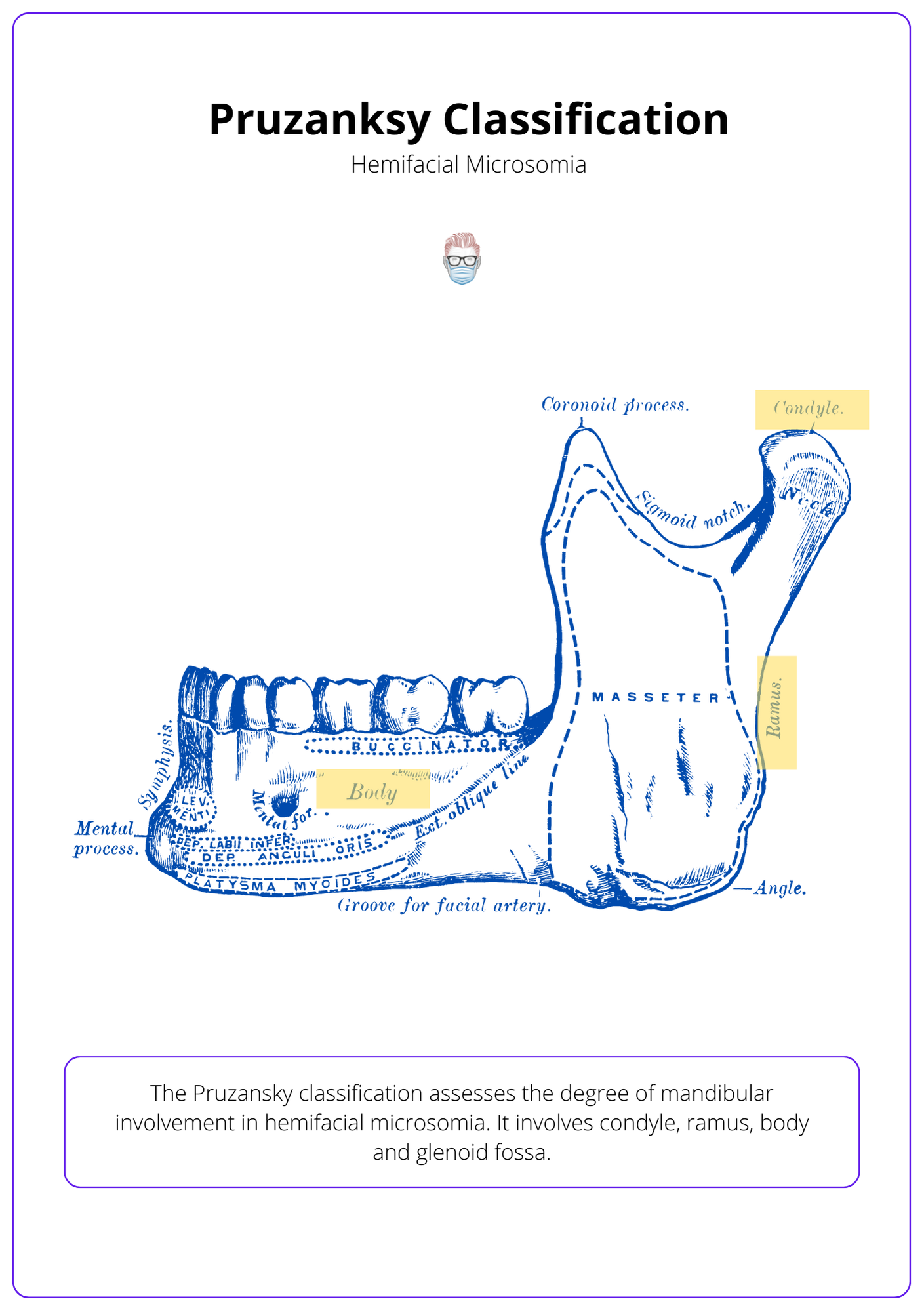 Pruzansky Classification of the Mandible, Classification of Hemifacial Microsomia