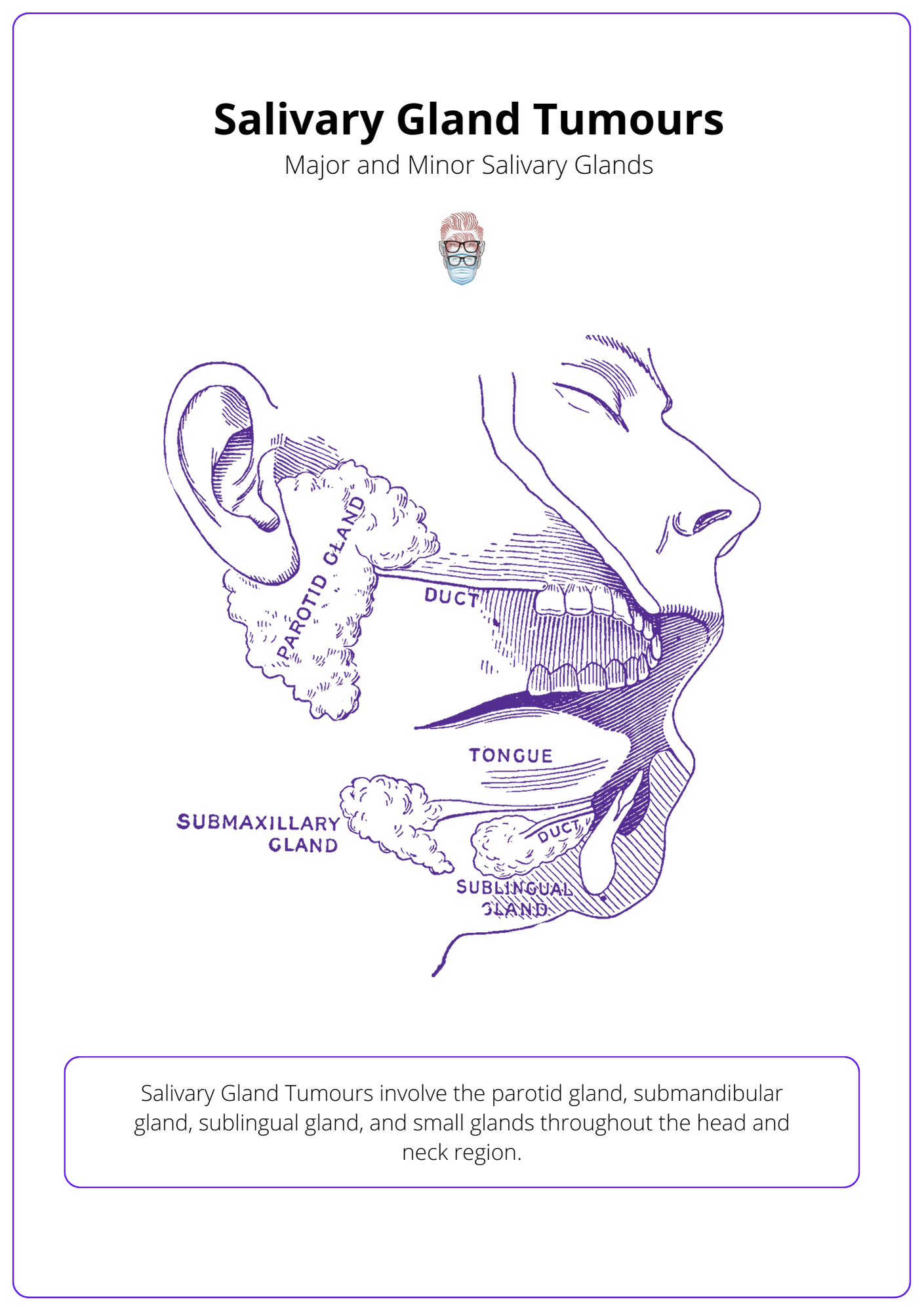 A labelled anatomical drawing showing Salivary Gland Tumours involve the parotid gland, submandibular gland, sublingual gland, and small glands throughout the head and neck region.
