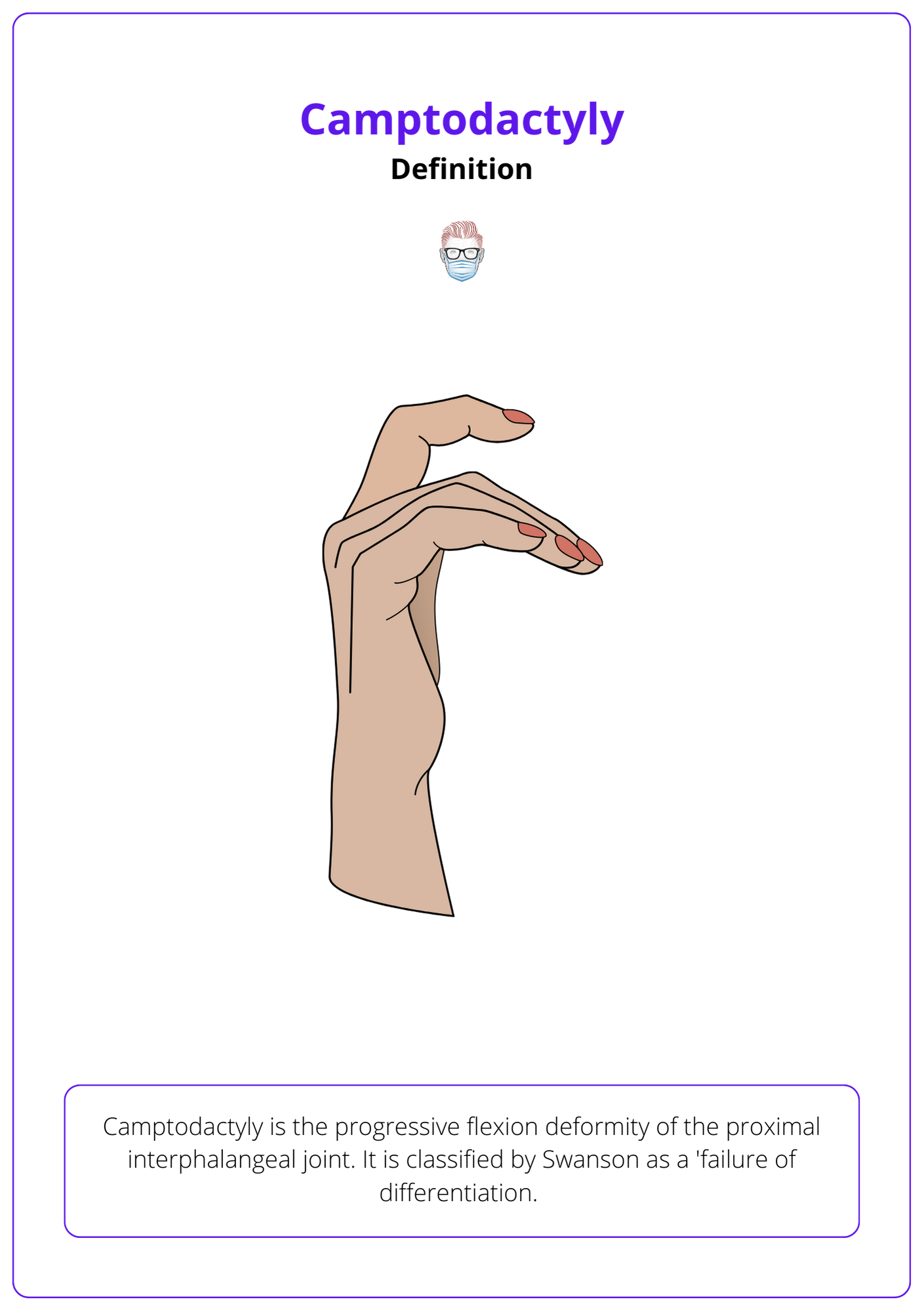 Definition of Camptodactyly