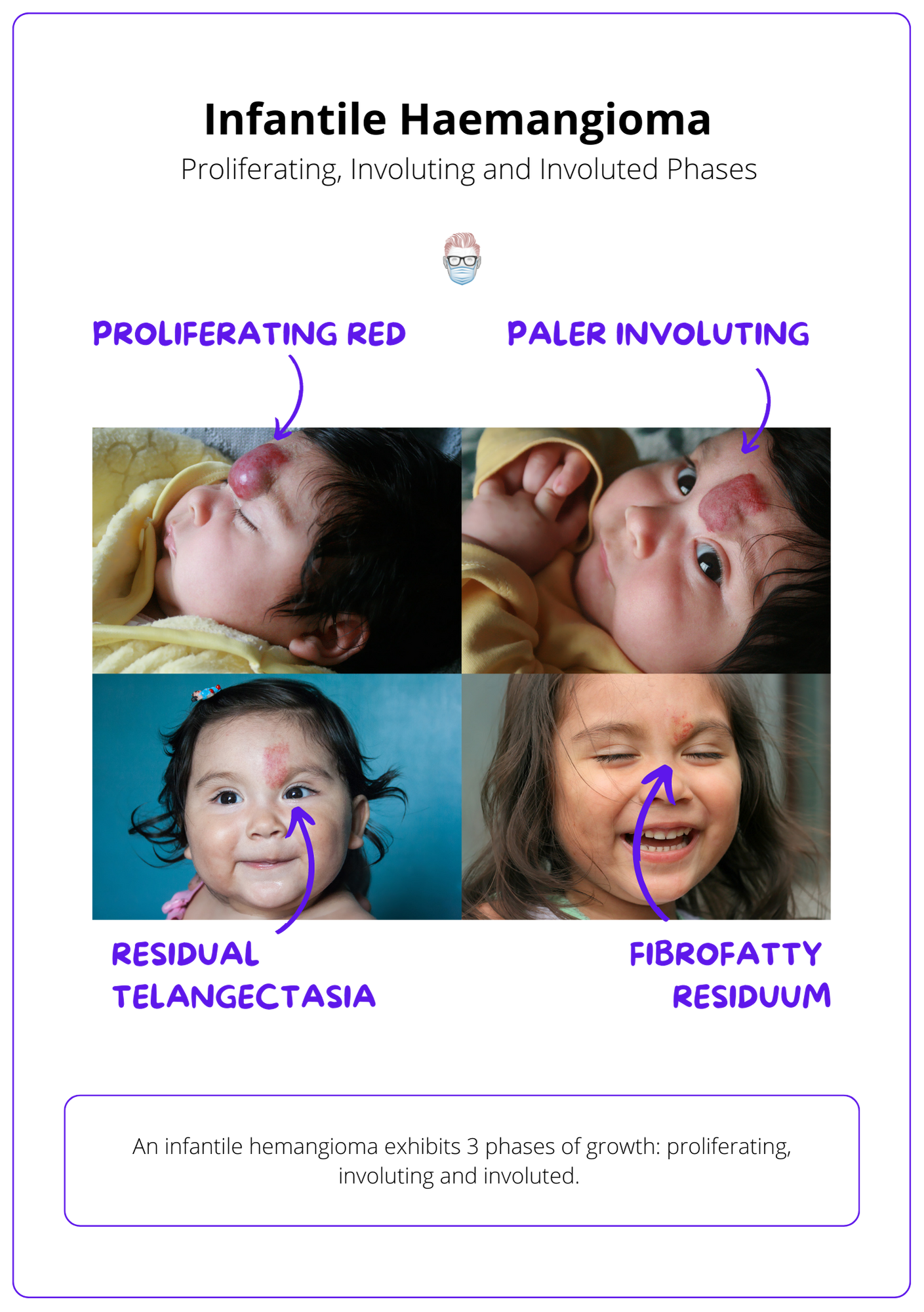 Phases of Infantile Haemangioma, Identifying Infantile Haemangioma