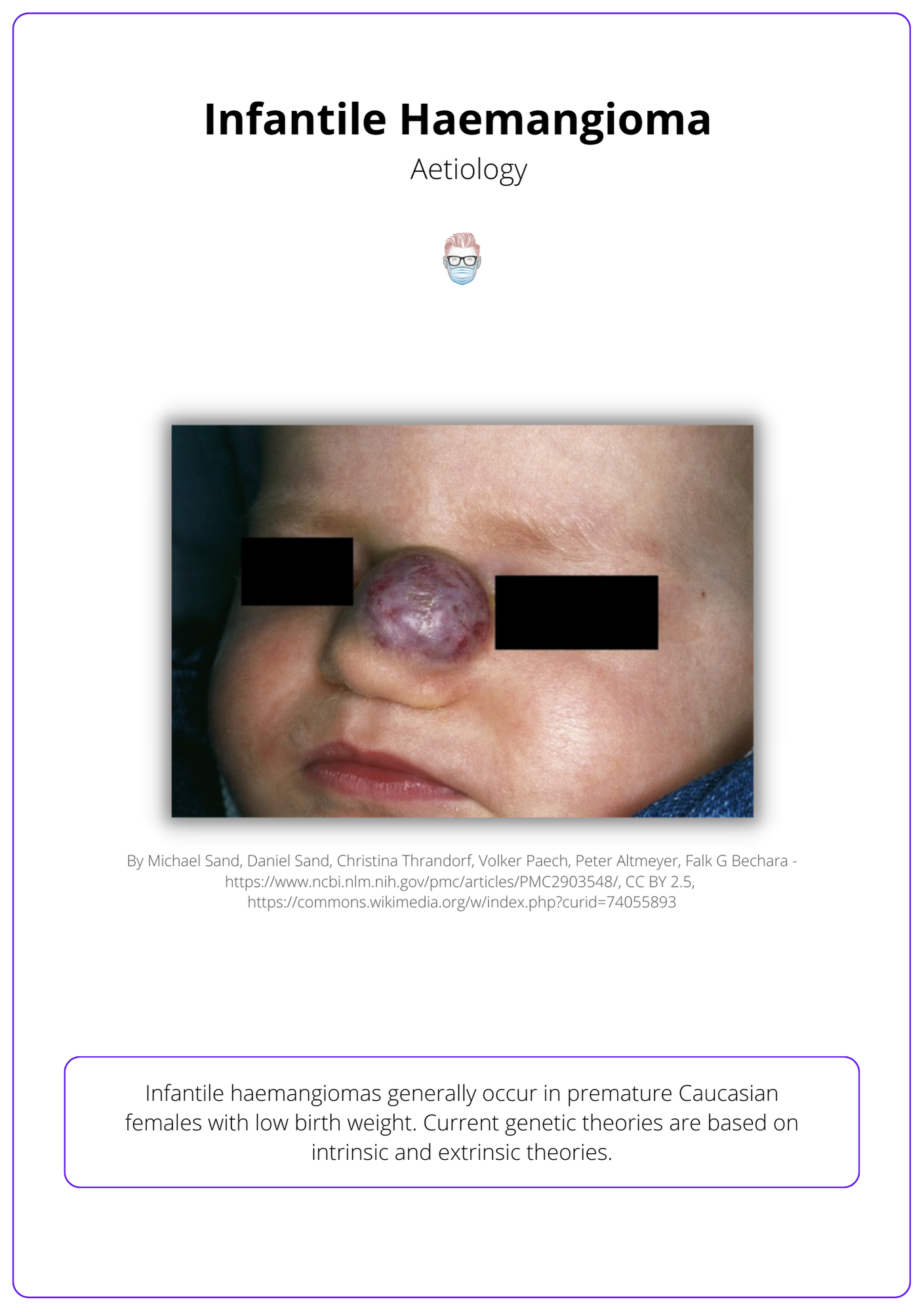 Infantile Haemangiomas