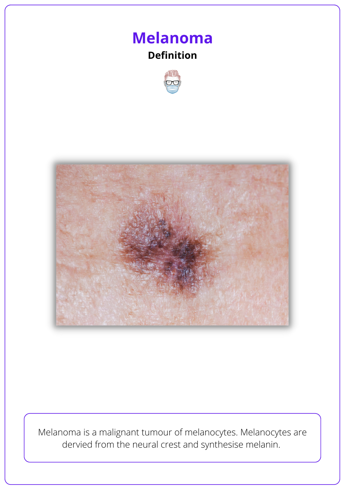 Melanoma Definition