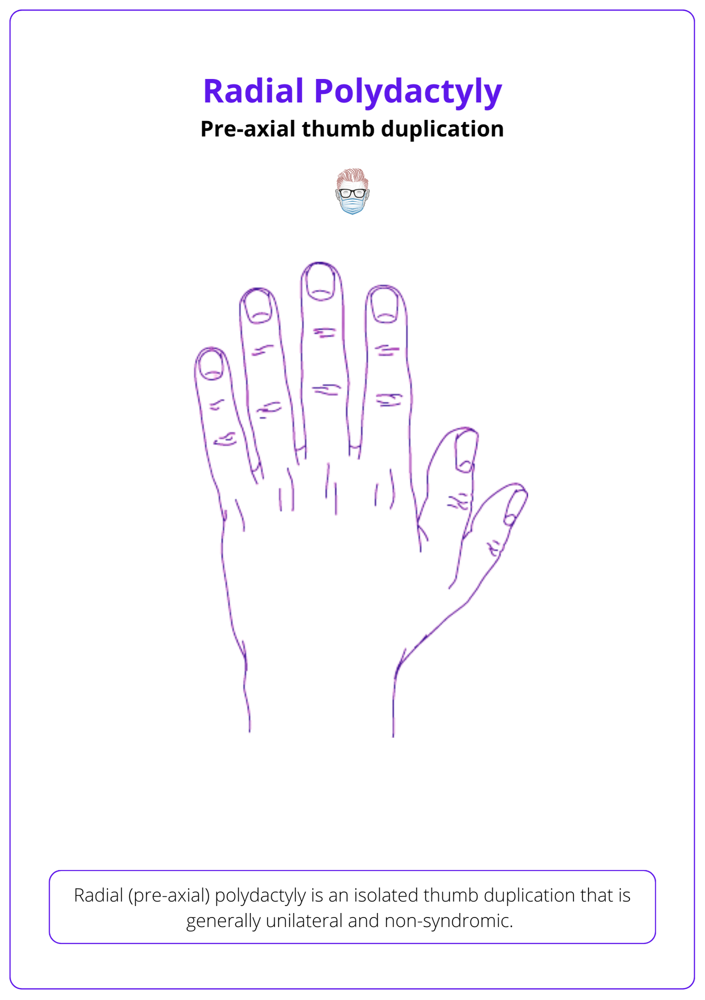 Radial Polydactyly Signs