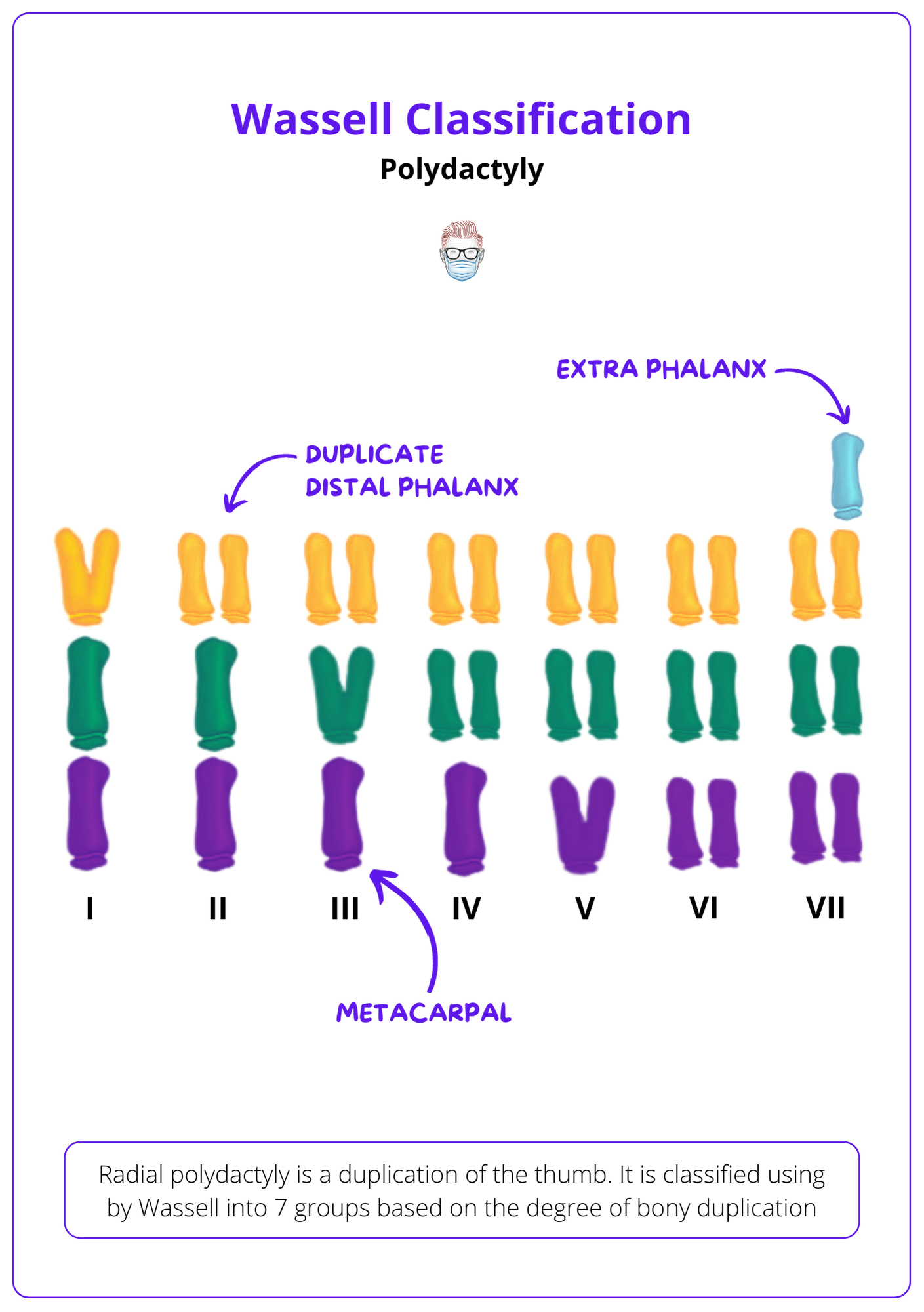 Polydactyly: Classification & Treatment