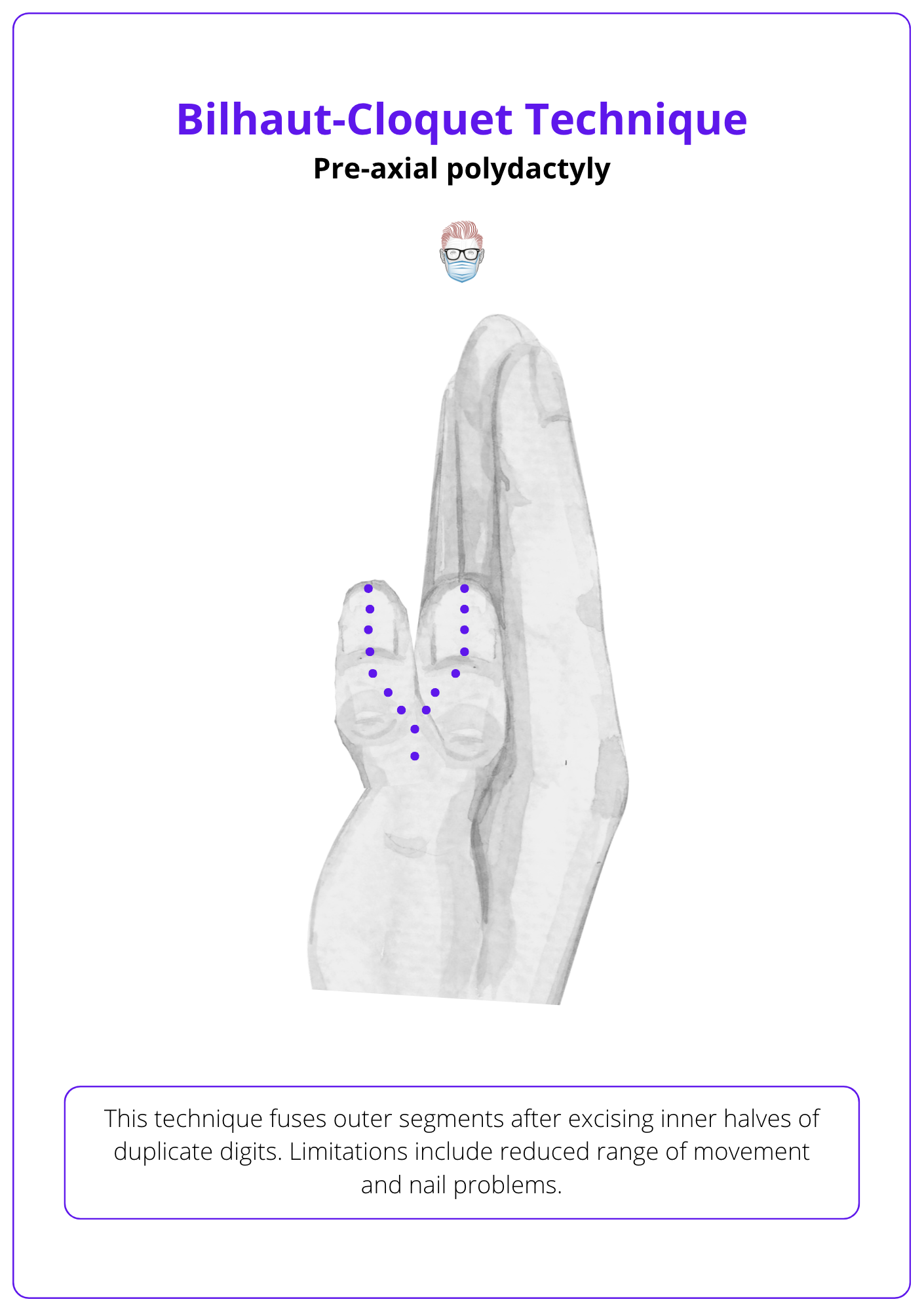 Polydactyly: Classification & Treatment