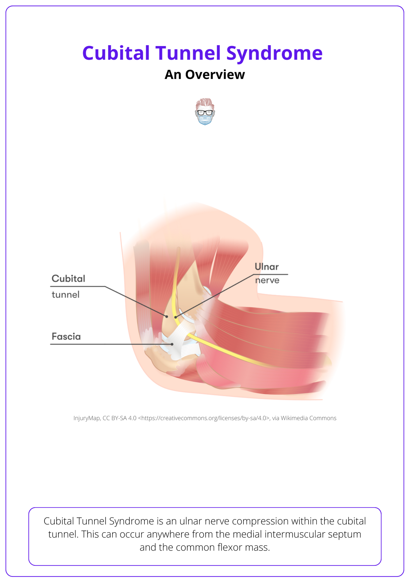 This image is an overview of Cubital Tunnel Syndrome in Upper Limb Surgery.