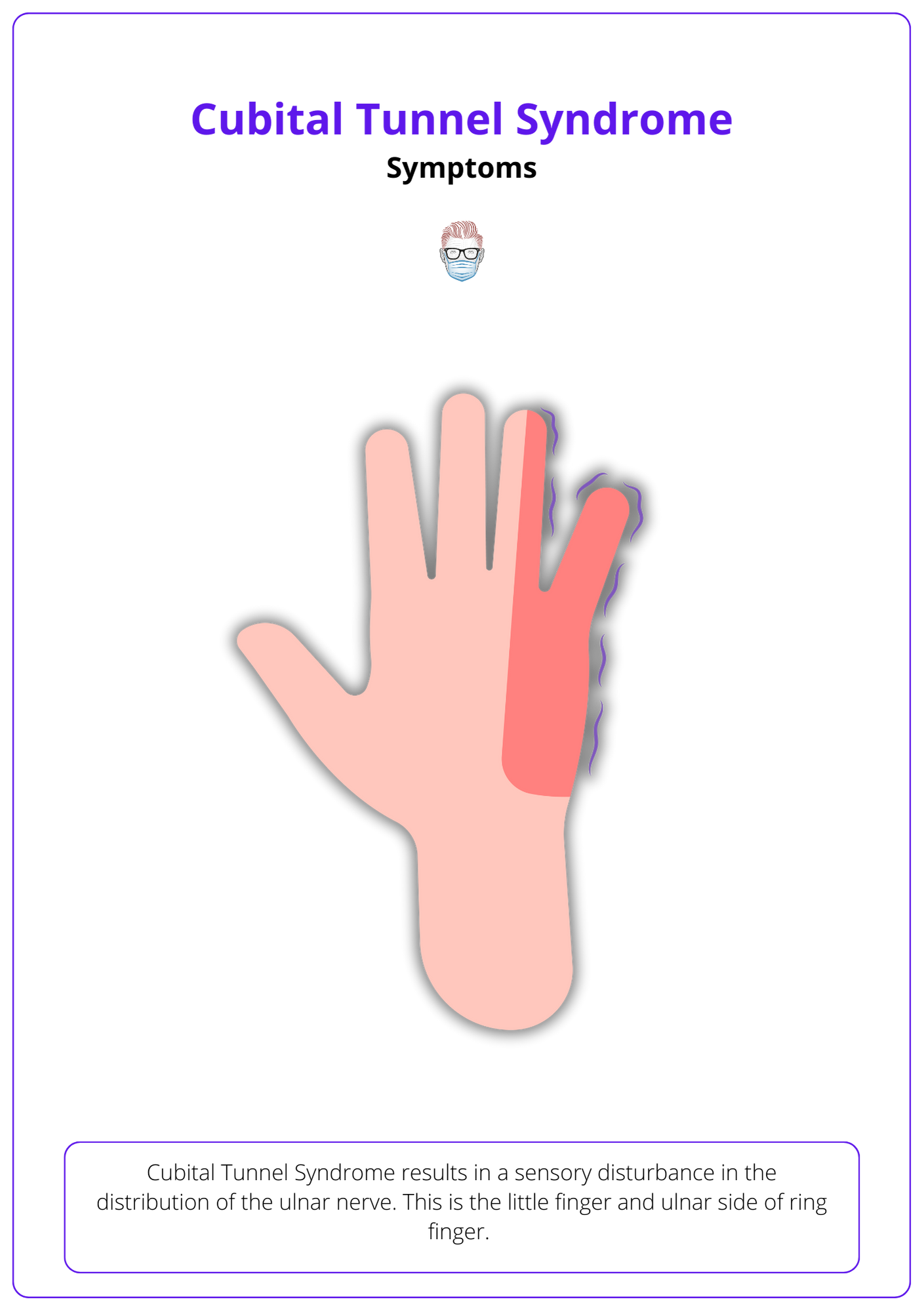 This image shows the Sensory Disturbance in the symptoms of Cubital Tunnel syndrome.