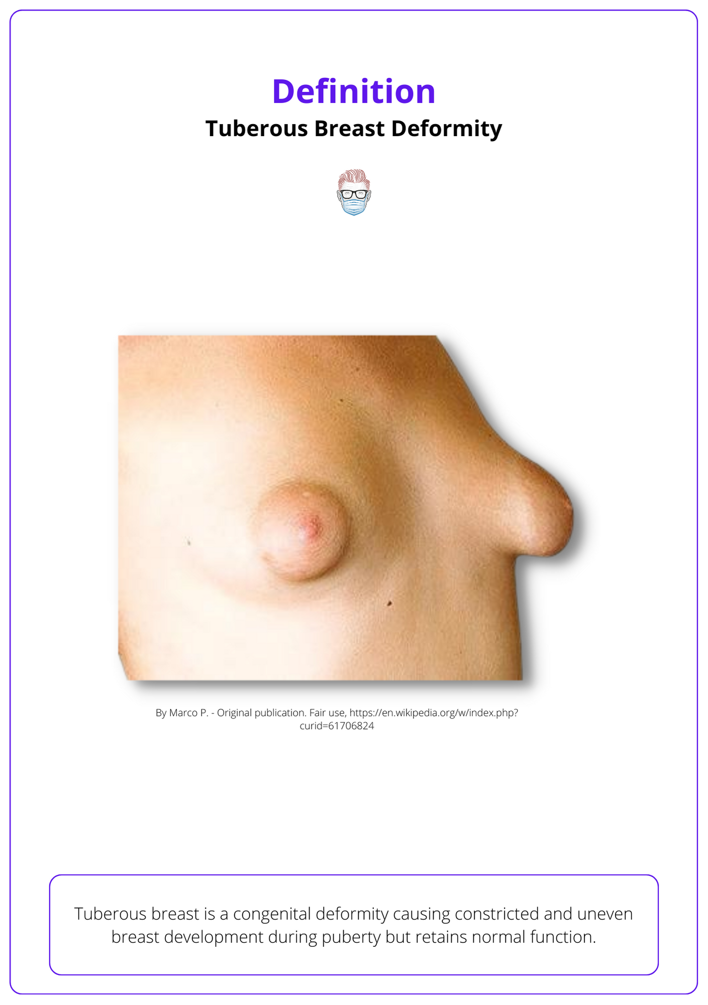 Various types of breast deformities. a Grade I breast contracture. a