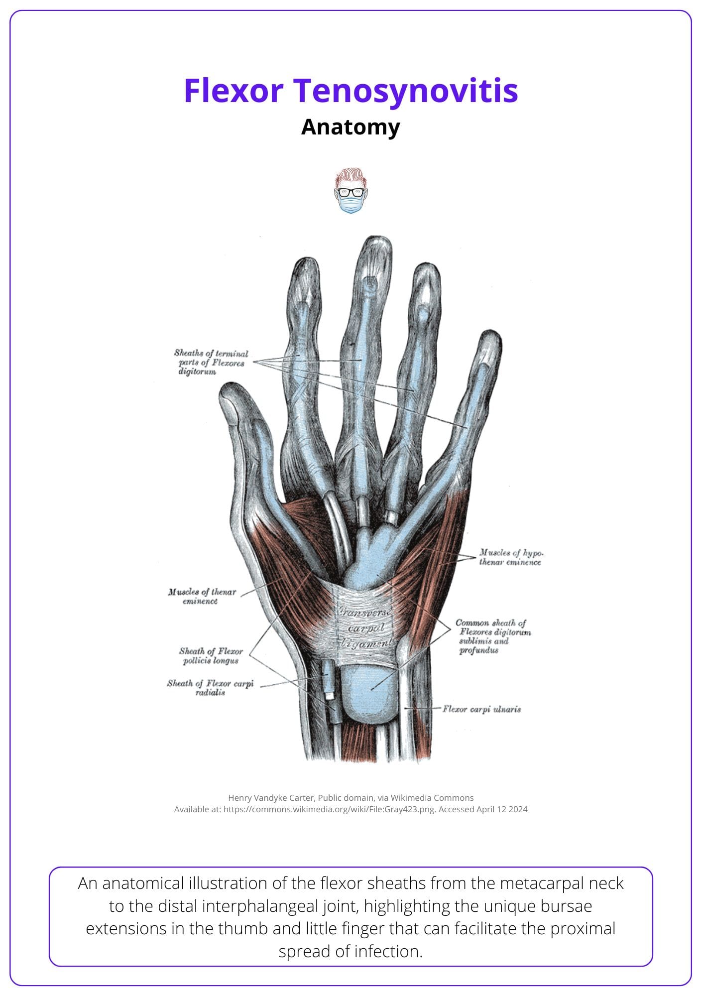 Volar hand anatomy of flexor tendons, flexor sheaths, and bursae.
