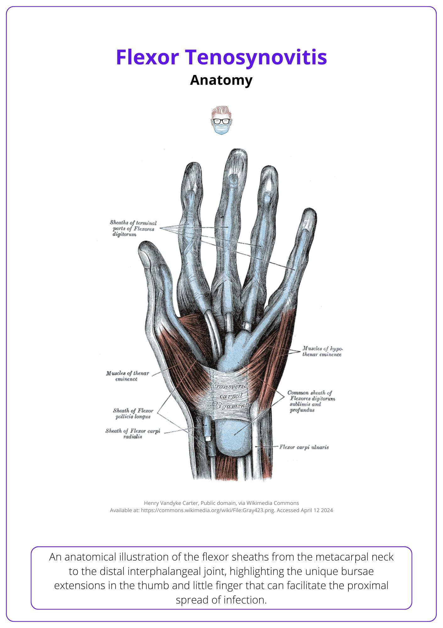 Flexor Tenosynovitis: Anatomy, Clinical Features, & Treatment