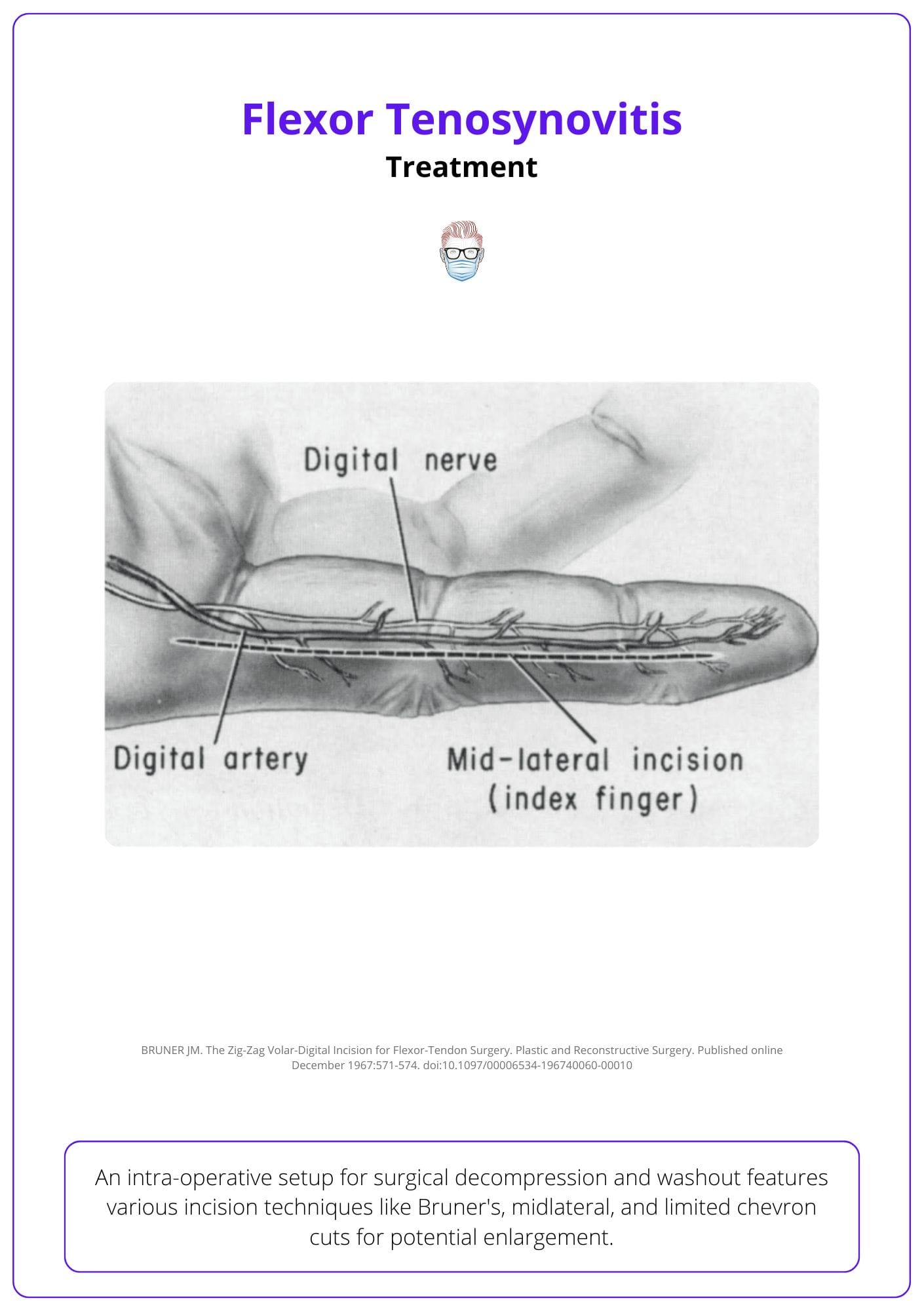 Image of mid-lateral incision and markings of various incision options.