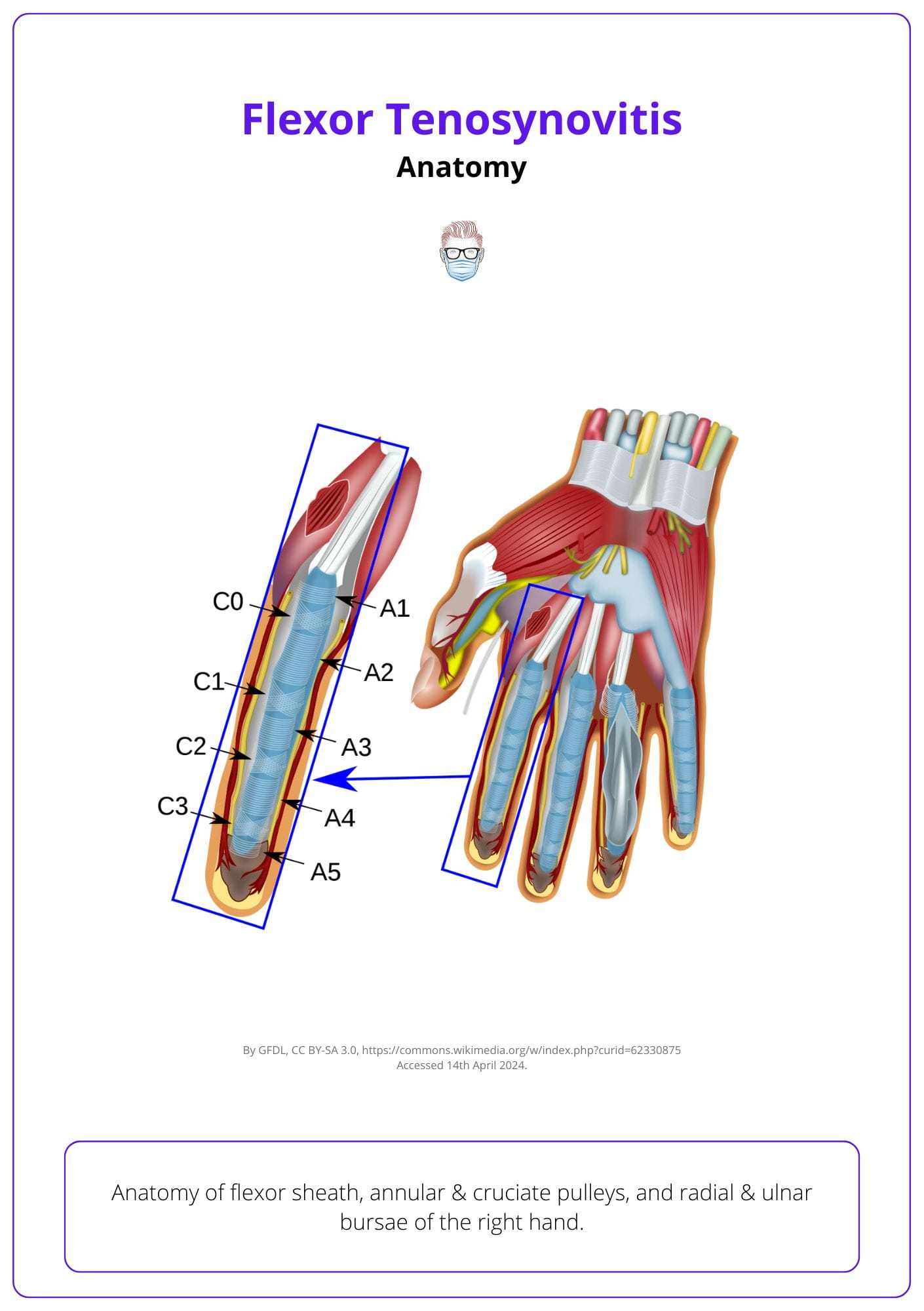 Flexor Sheath Anatomy of the right hand, including annular & cruciate pulleys, and radial & ulnar bursae. 