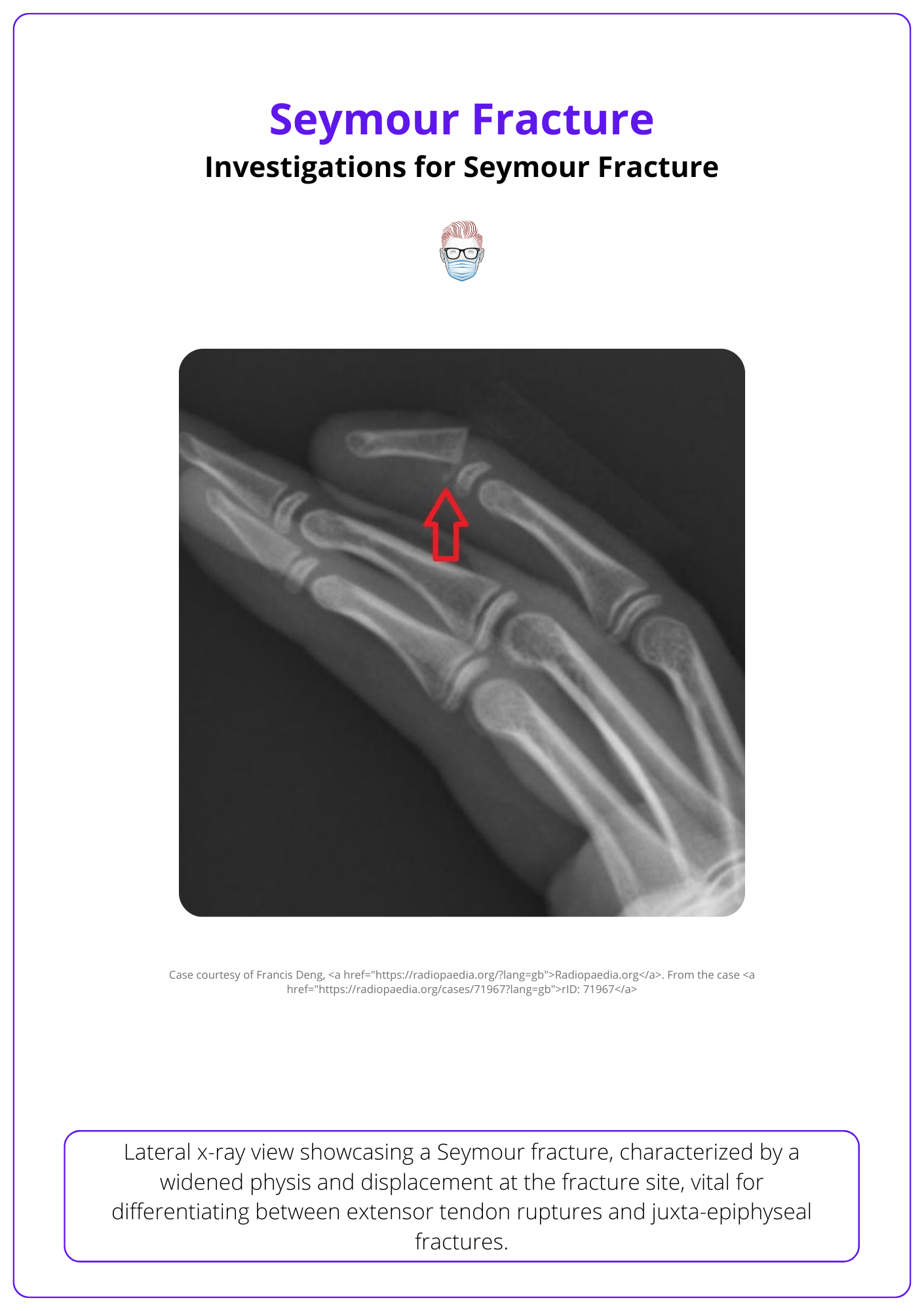 Seymour fracture on the lateral view of an X-ray, Diagnosing Seymour Fracture