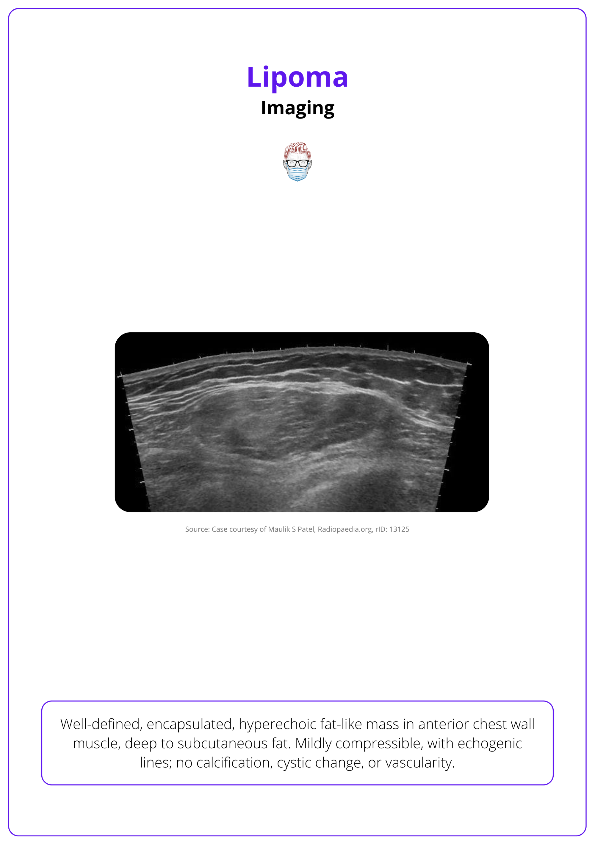 The identification of a lipoma in ultrasound