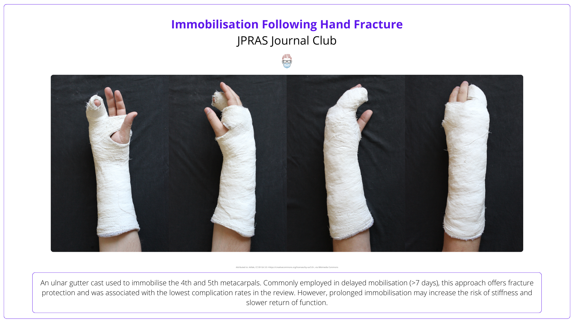 Immobilisation following hand fracture