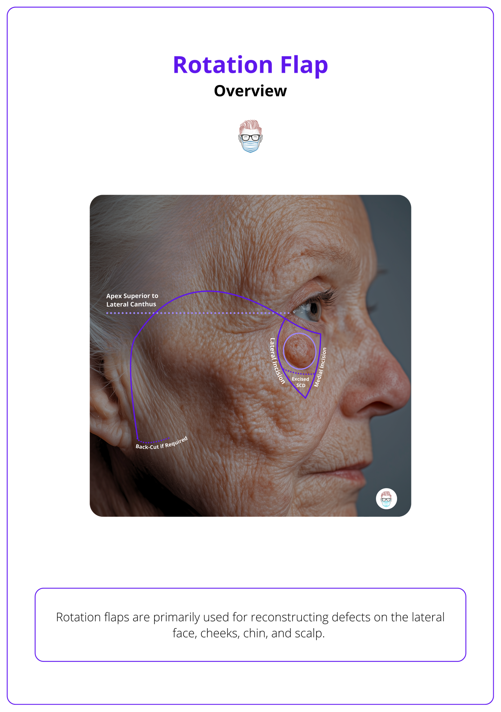 How to Design a Rotation Flap