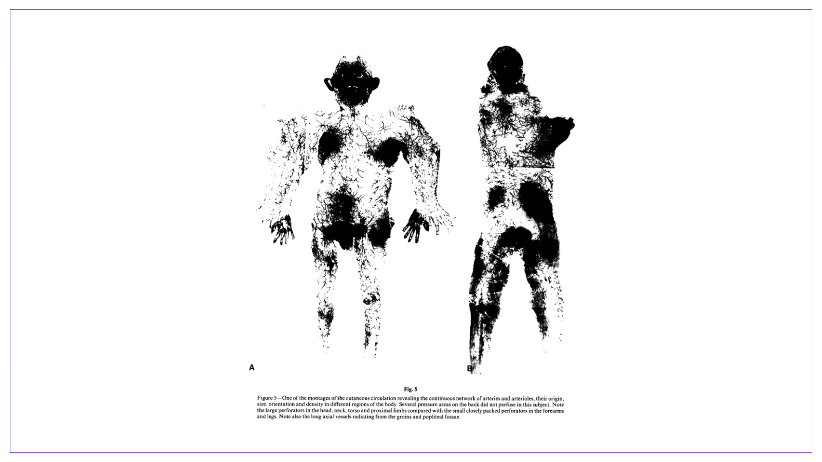 Original Publication of Angiosomes